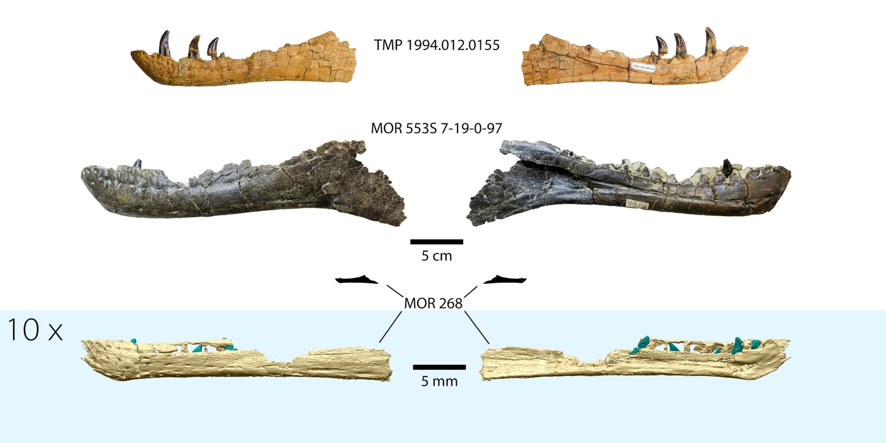 jaw comparison