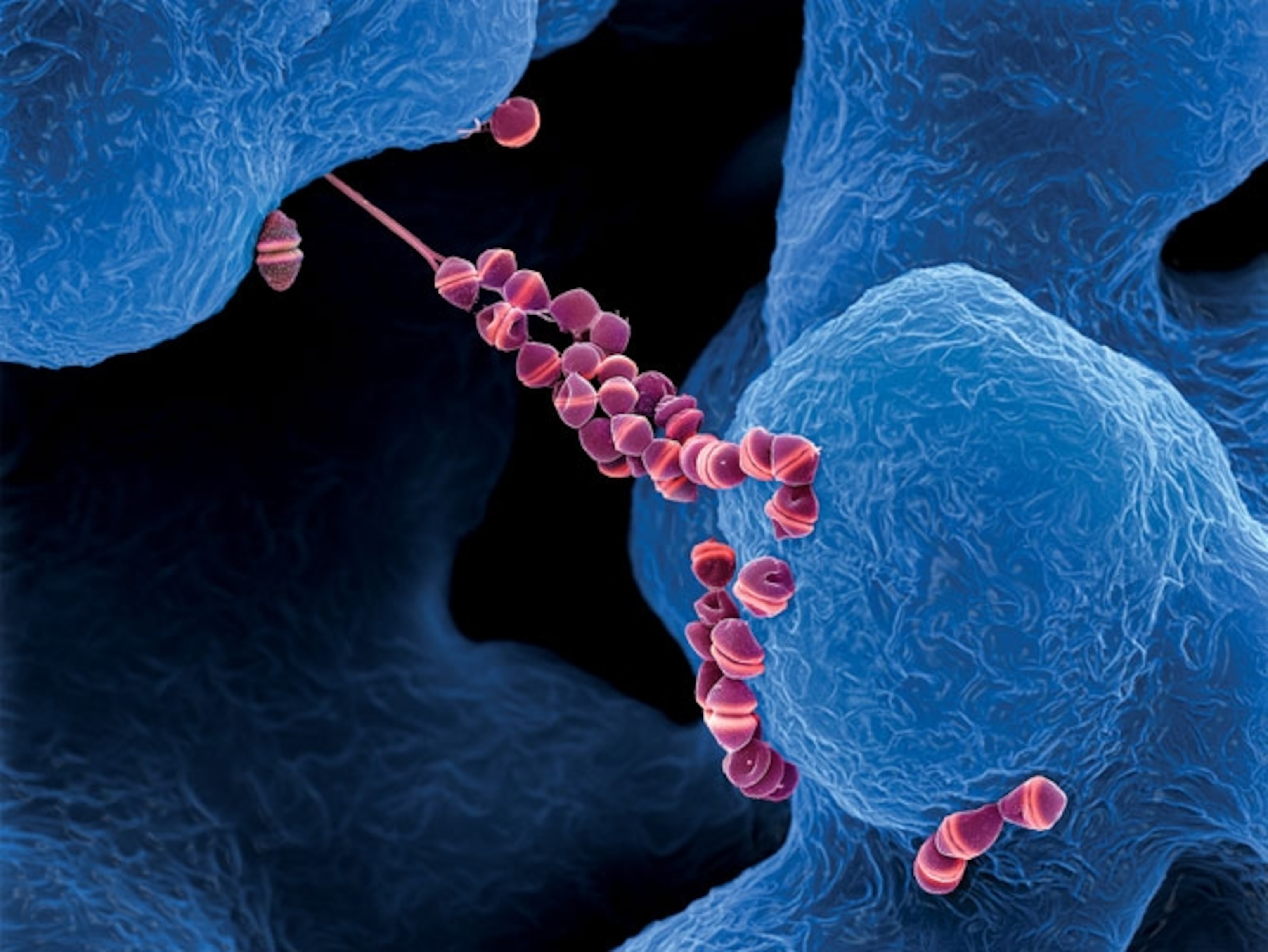 Streptococcus