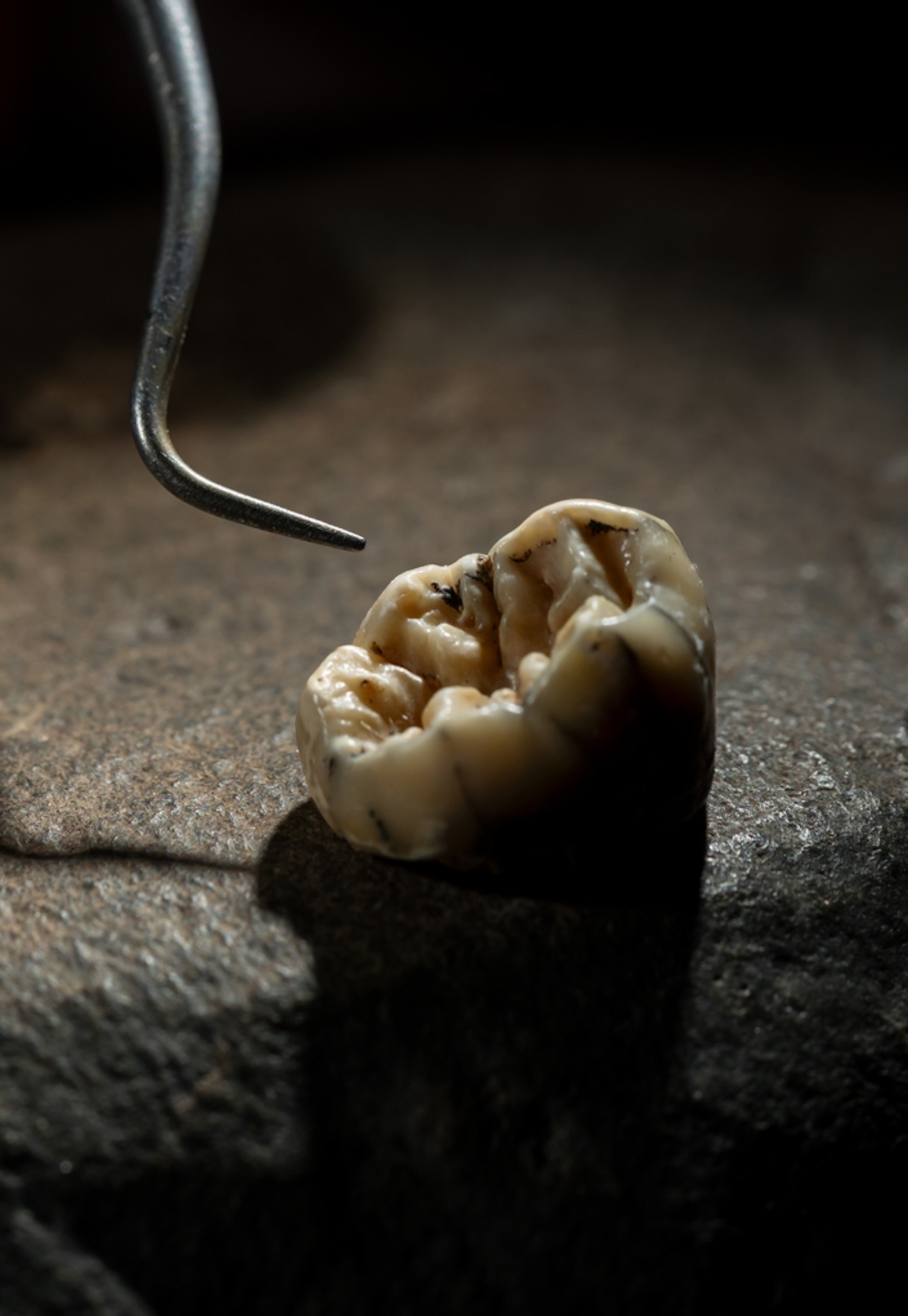 A close-up image of a molar.