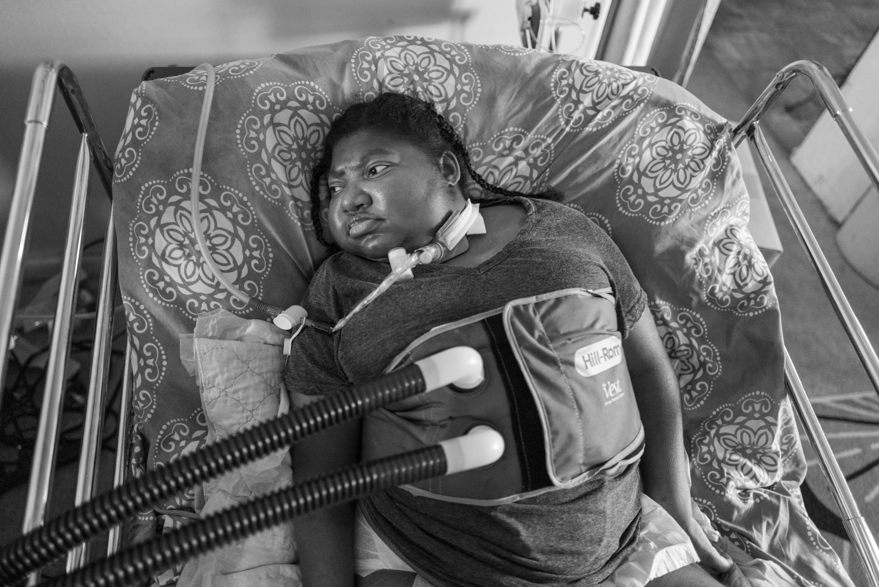 a young black and overweight girl lays in a bed with a ventilator attached to her neck and addiitional tubes attached to a fabric wrapped around her abdomen.