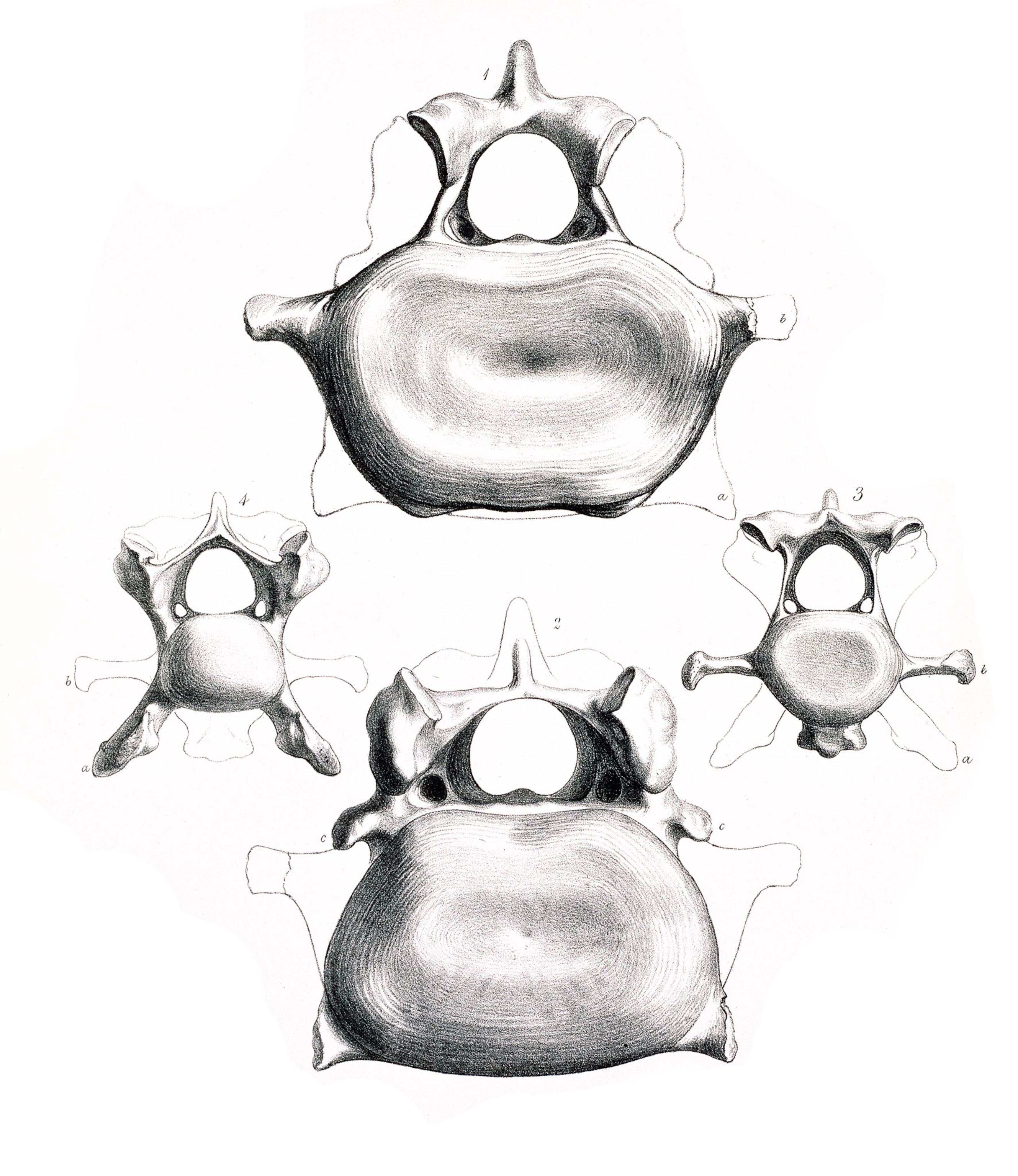 A drawing of a vertebrae