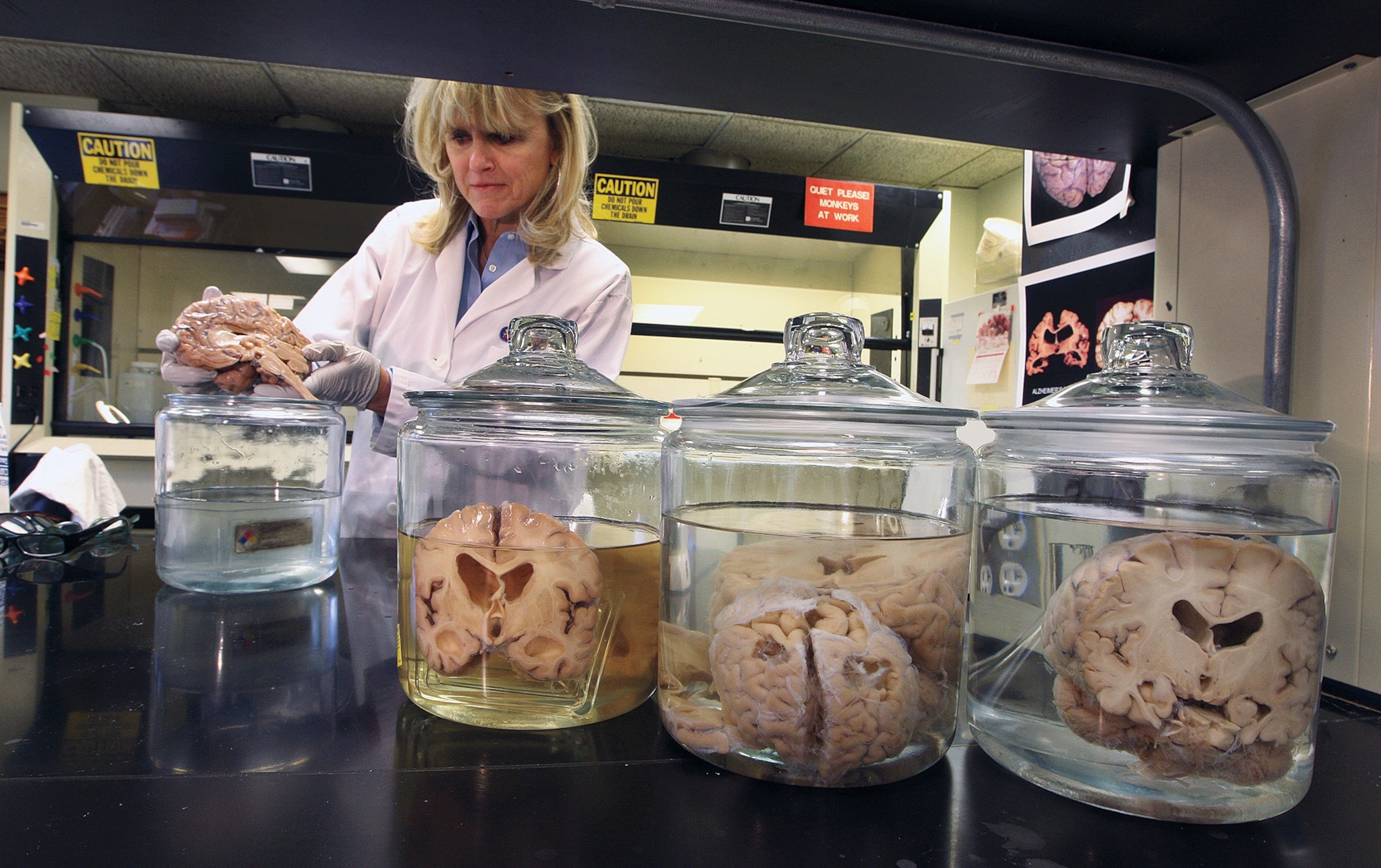 A woman stands over jars of brains while carefully inspecting one.
