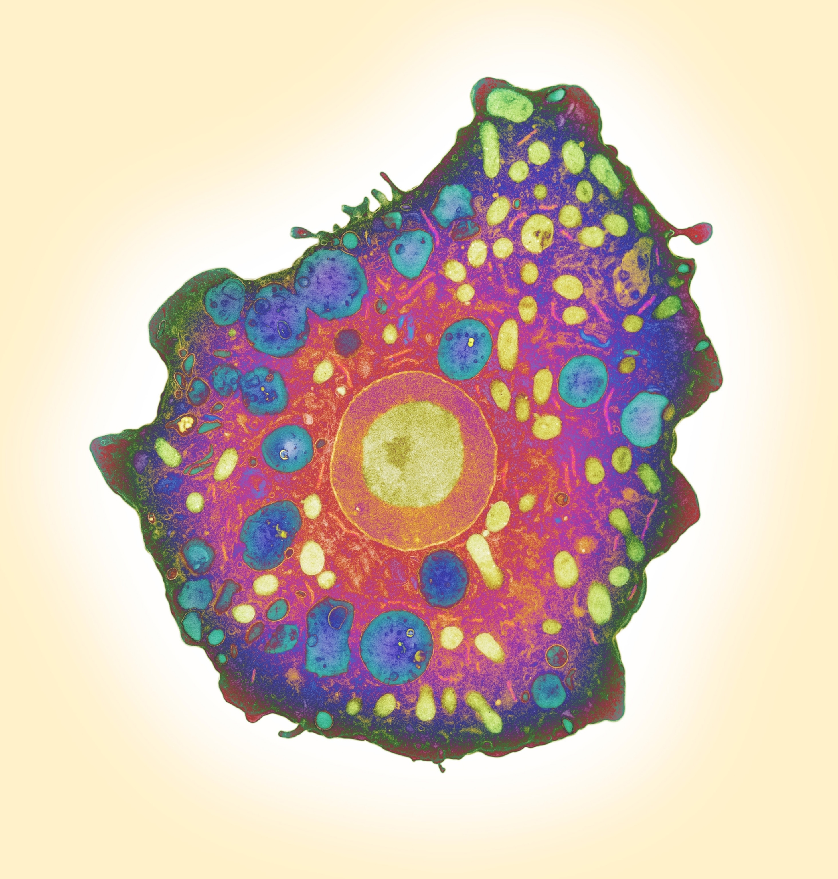Colored transmission electron micrograph (TEM) of a section through a Naegleria fowleri protozoan.