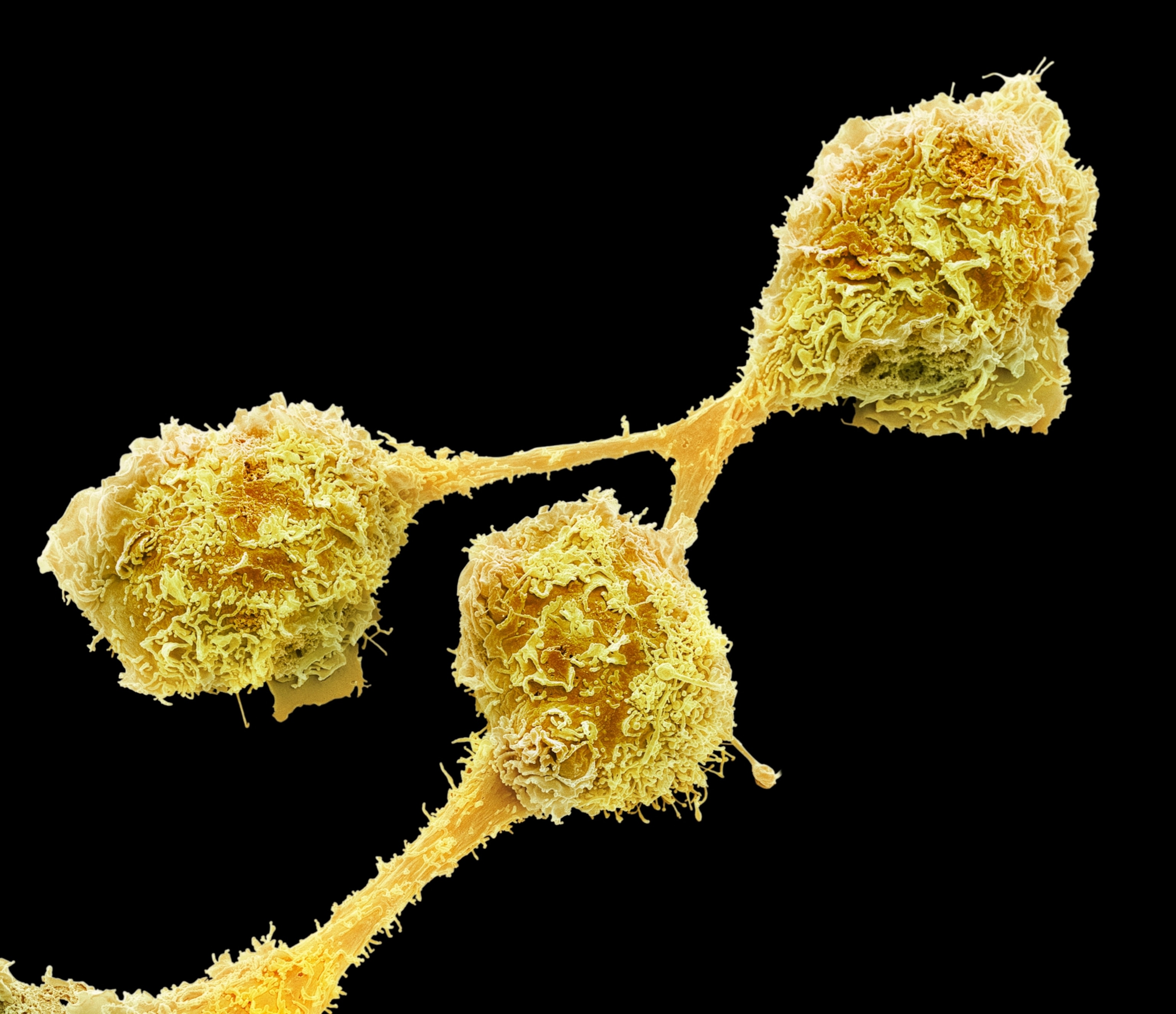 A scanning electron microscopic view of microglia, which appear as rough spheres connected by stretching strands.