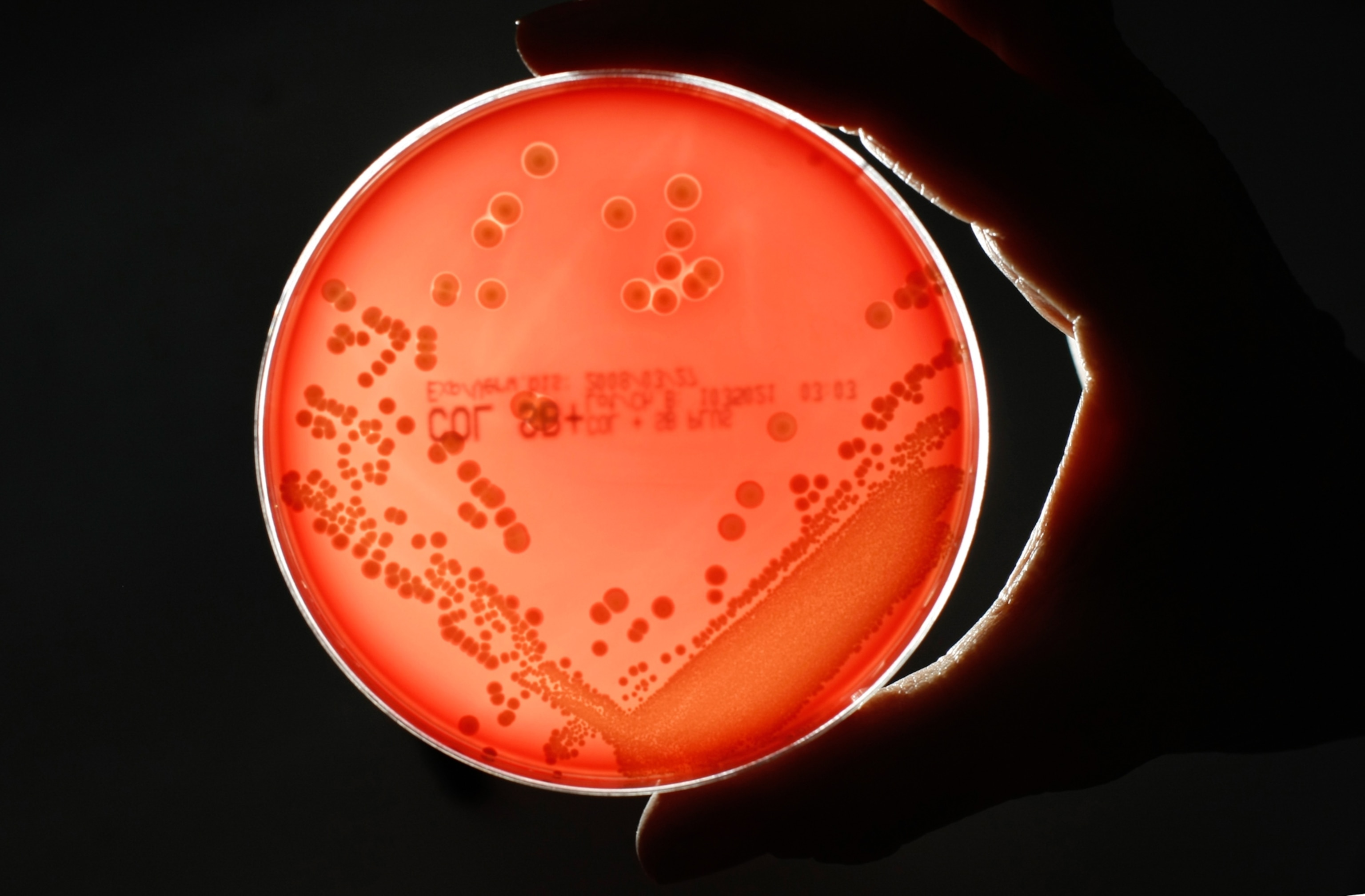 A petri dish with a red agar base layer, which is supporting round colonies of MRSA bacteria seen scattered across the agar surface.