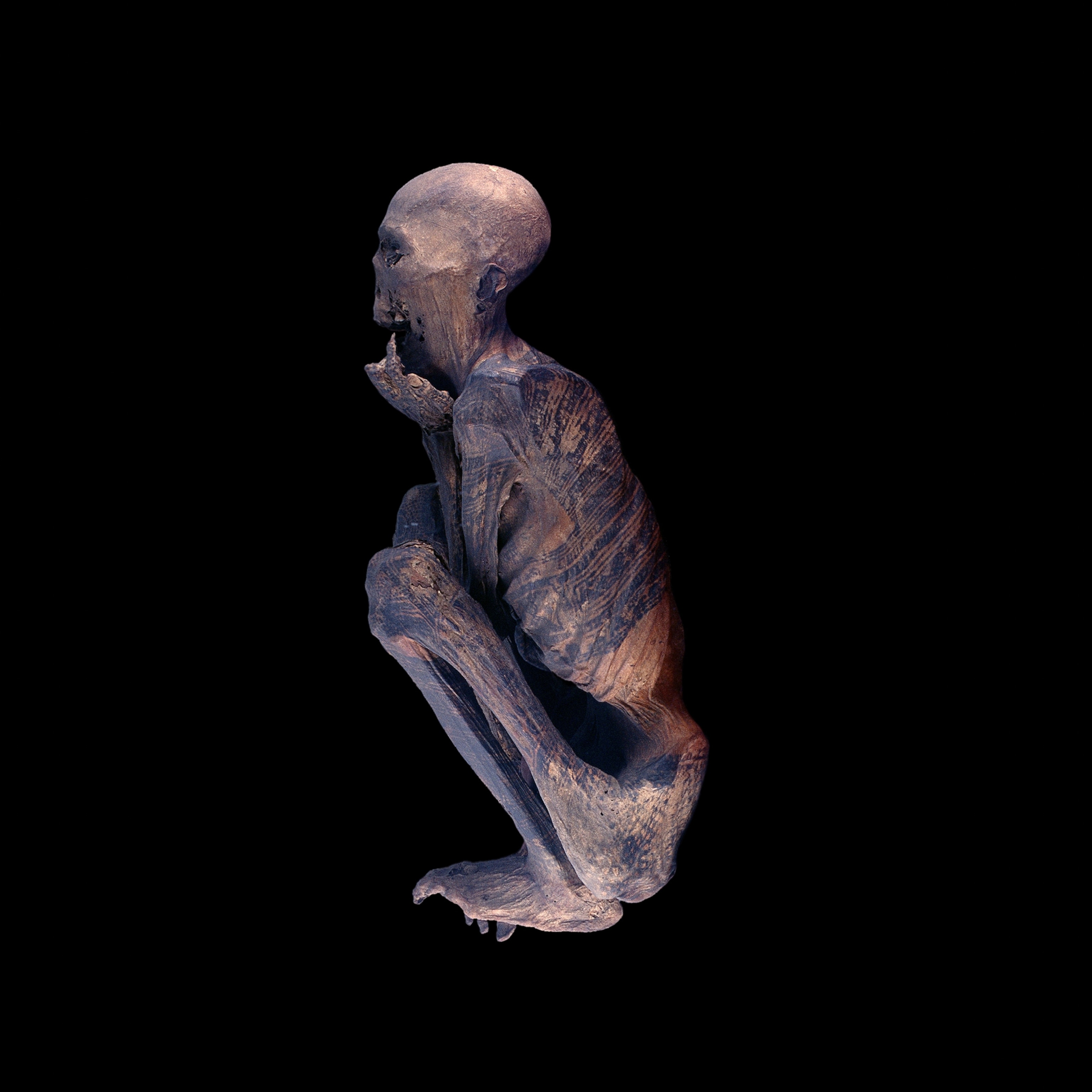 A rare Photo of The Fire Mummie/Ibaloi mummy, which is in a fetal position, its body covered with geometric tattoos.