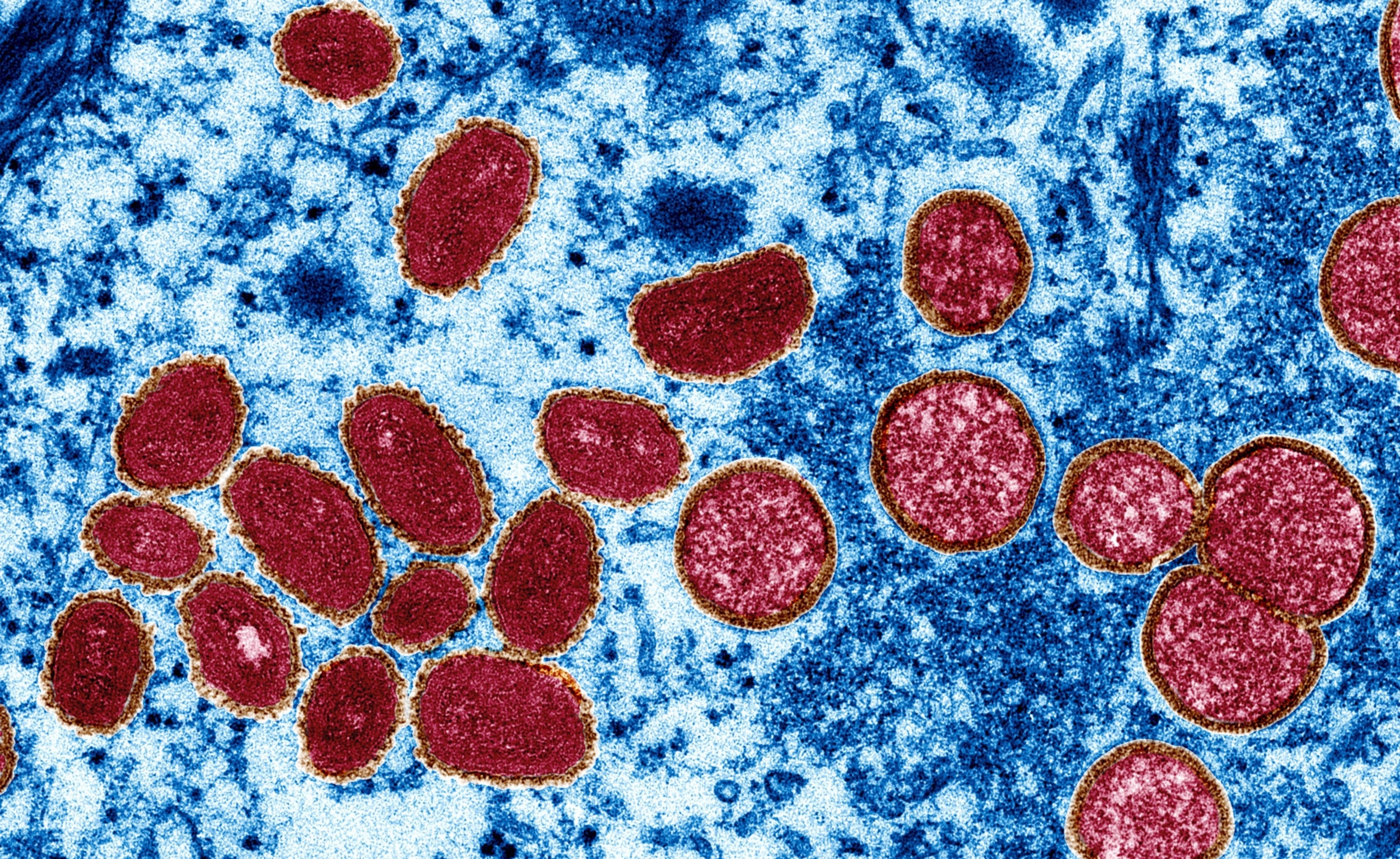 electron microscopic of monkeypox