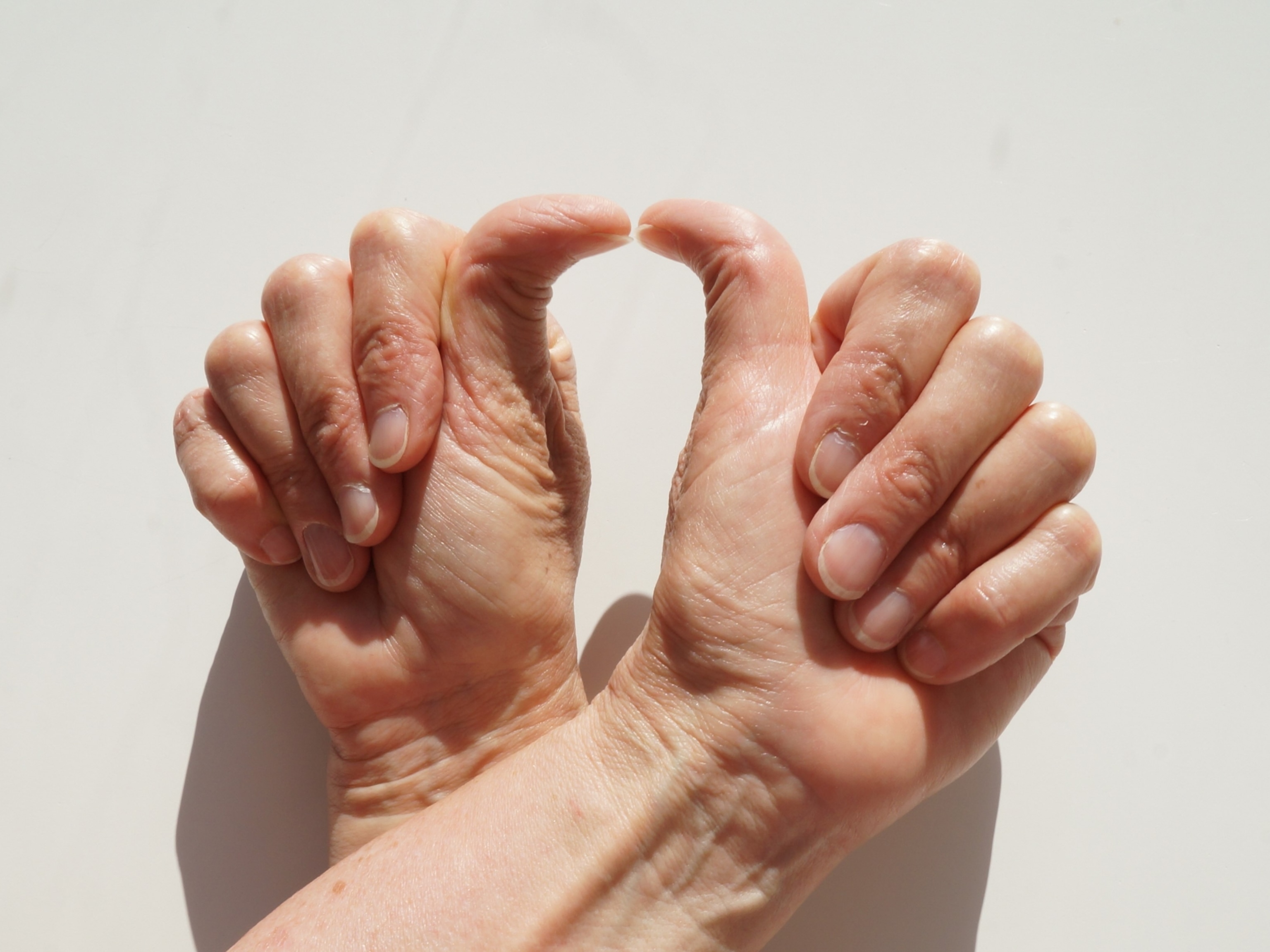 The back of a pair of hands where the thumbs can bend 90 degrees and the hands are crossed on top of each other. The thumbs face upwards towards each other and form an arch.