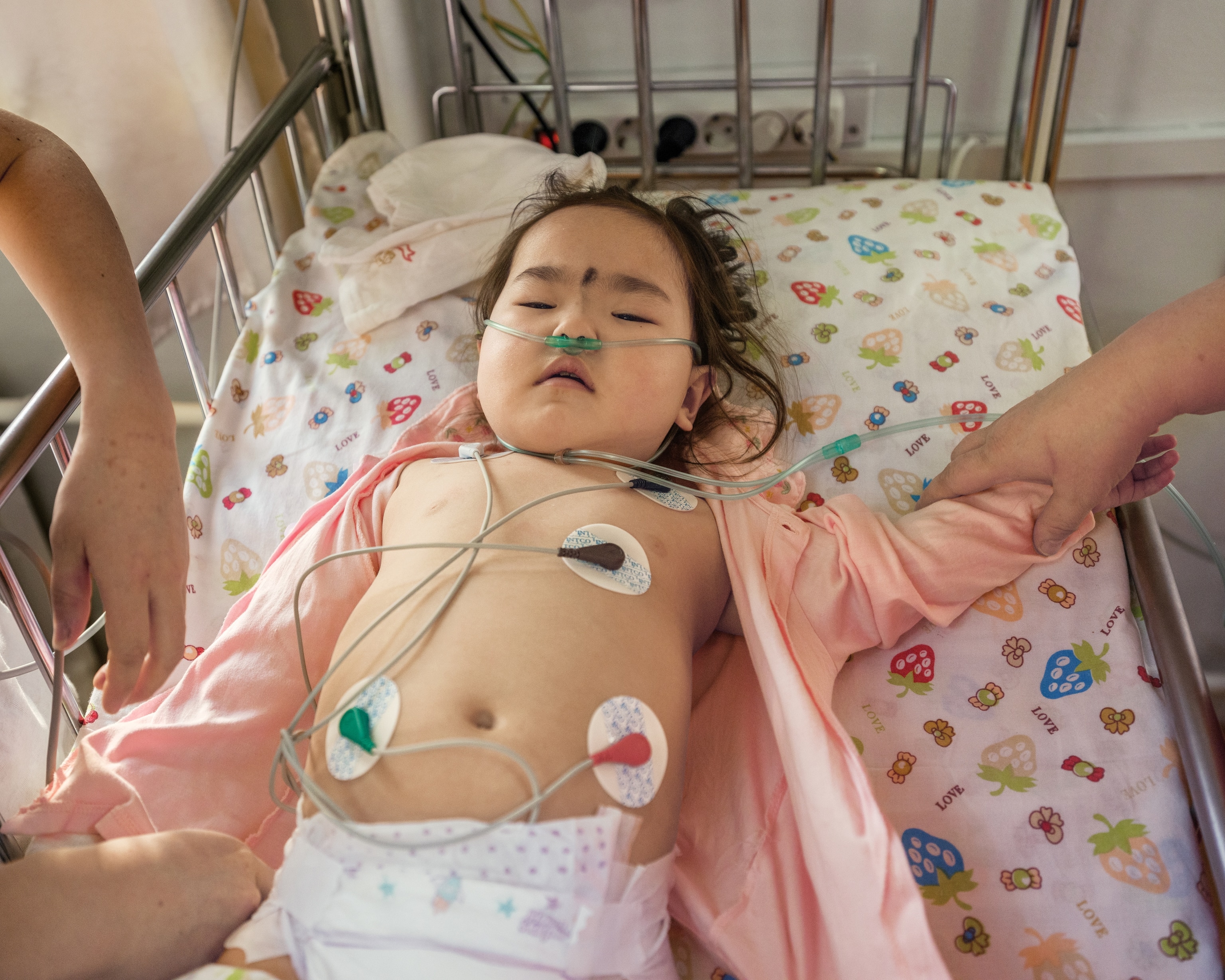 Picture of little girl on hospital bed with sensors attached to her body.