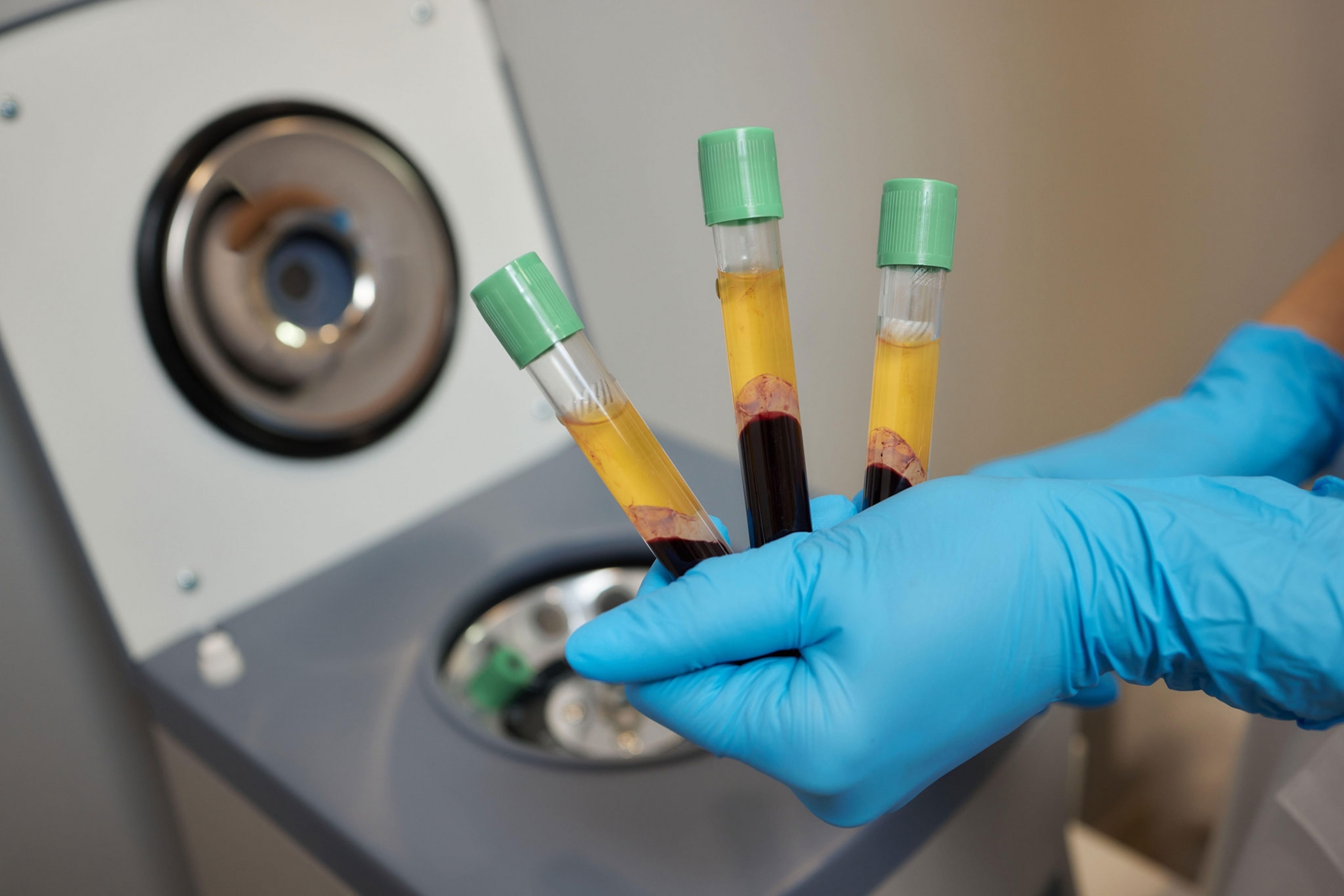 Hands, wearing blue surgical gloves can be seen holding three tubes containing blood and a yellowish substance floating above it. a centrifuge contain is seen in the background.