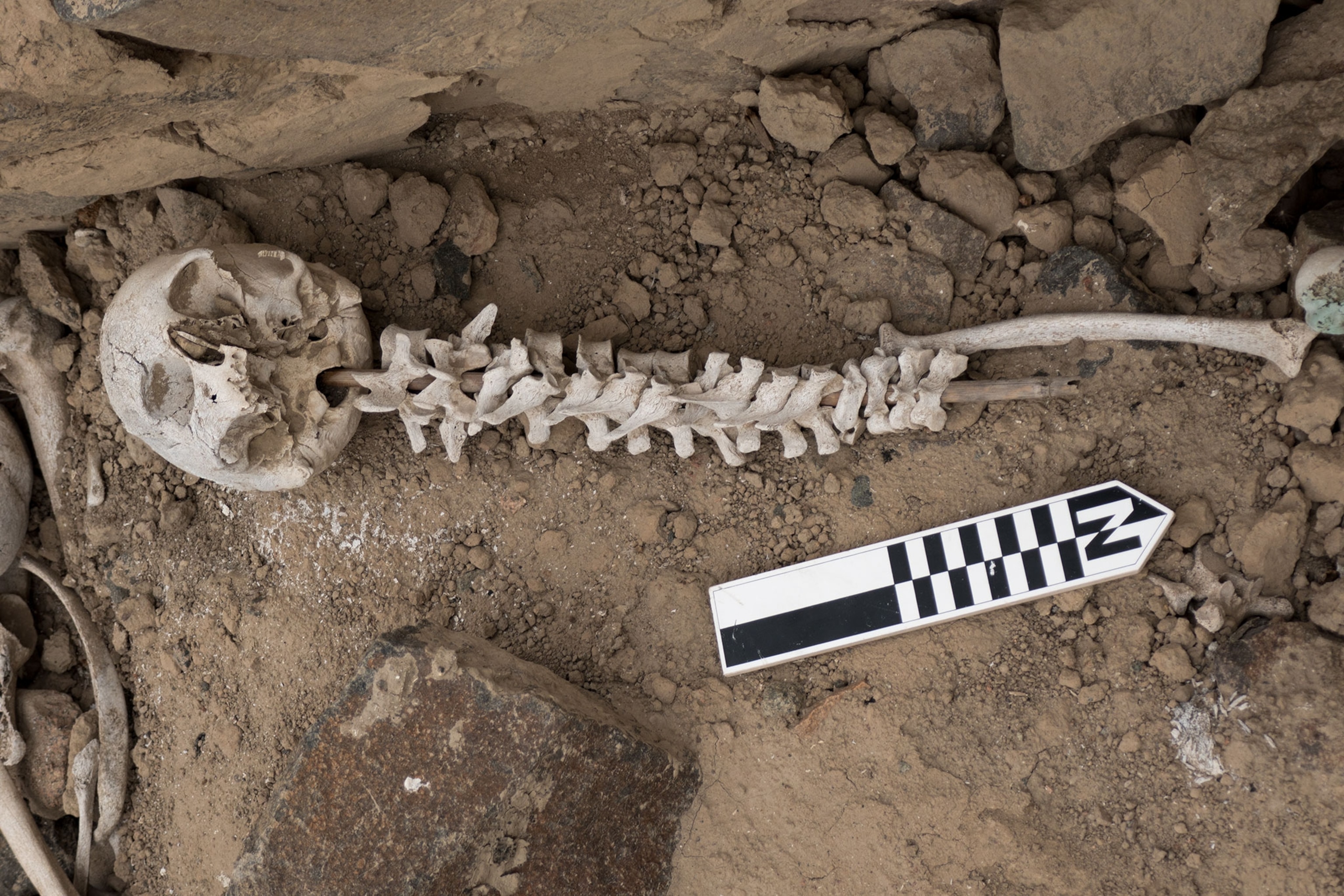 vertebrae organized on a post inserted into a skull