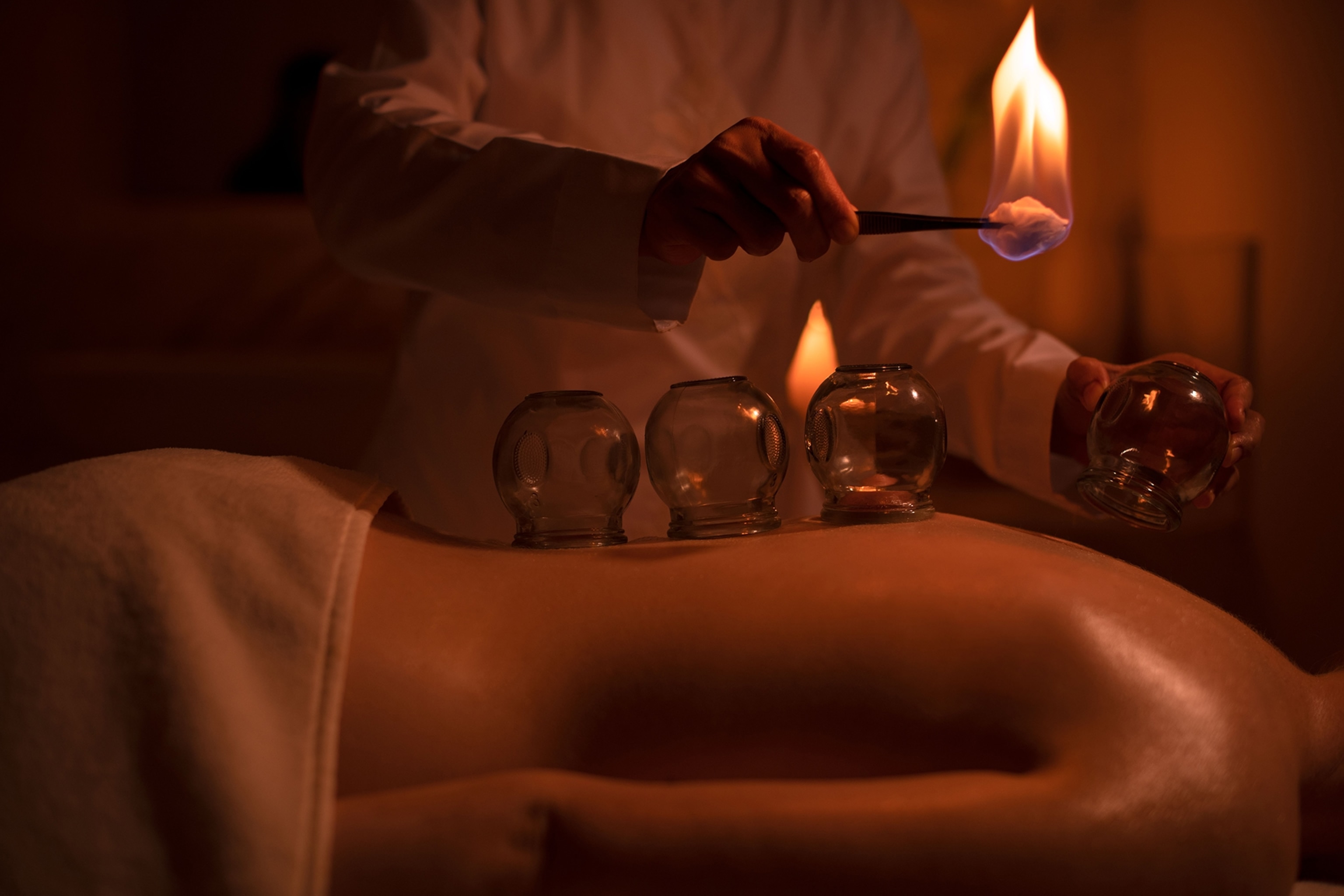 A low-lit spa treatment of a women getting her back cupped by vacuum glass bulbs.