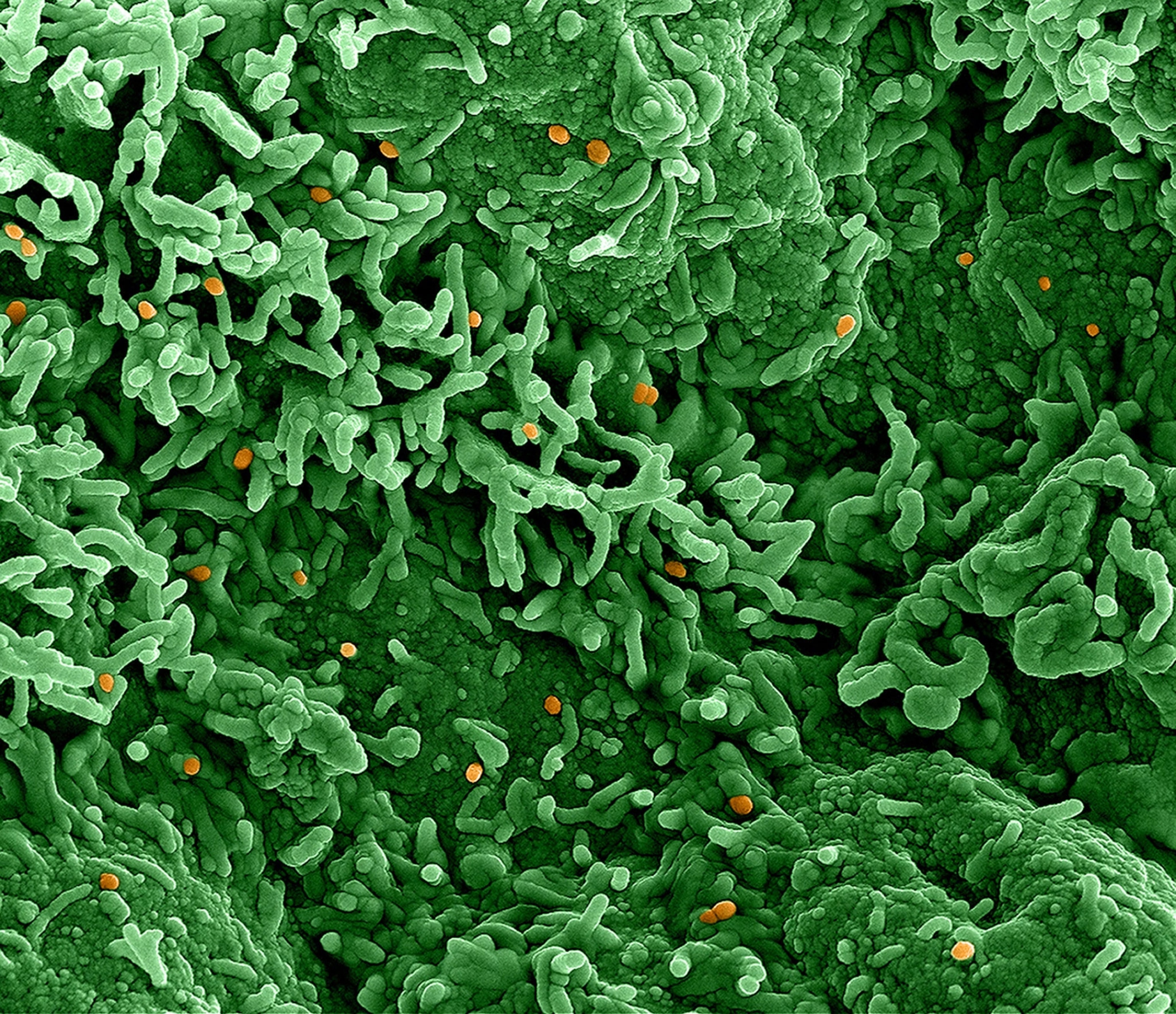 Colorized scanning electron micrograph of monkeypox virus (orange) on the surface of infected VERO E6 cells (green)