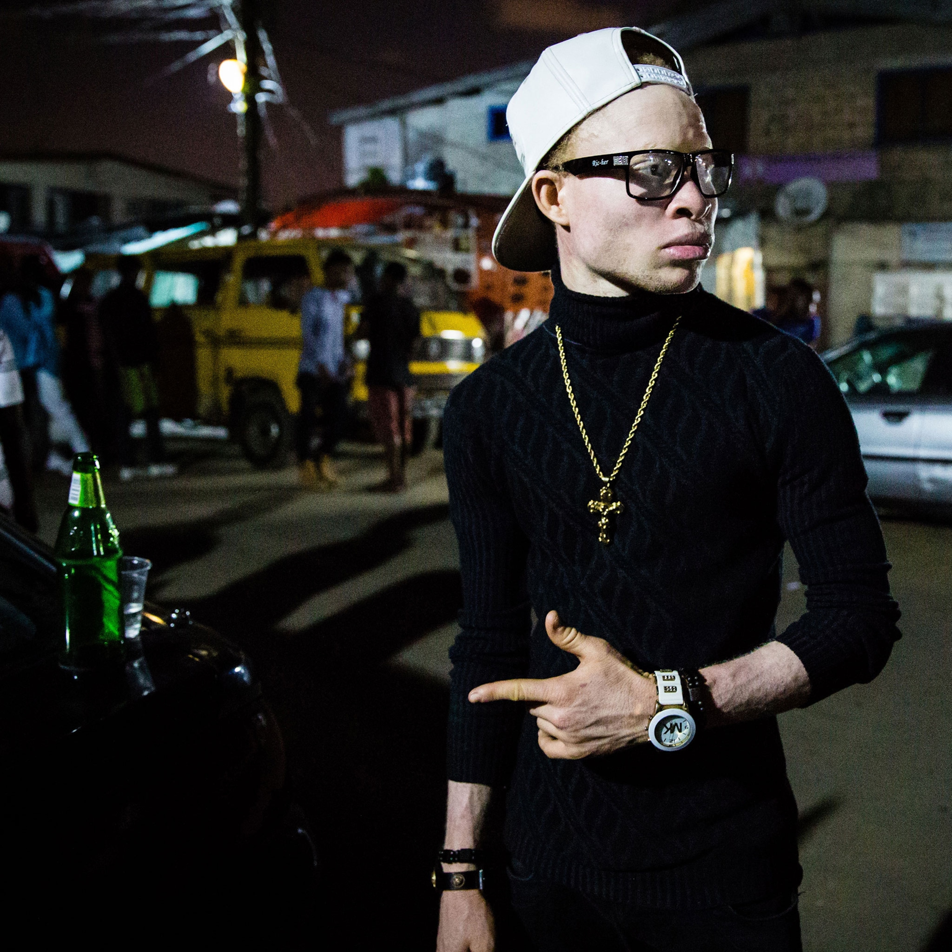 Omotore, a 21-year-old albino hip-hop artist, Lagos, Nigeria