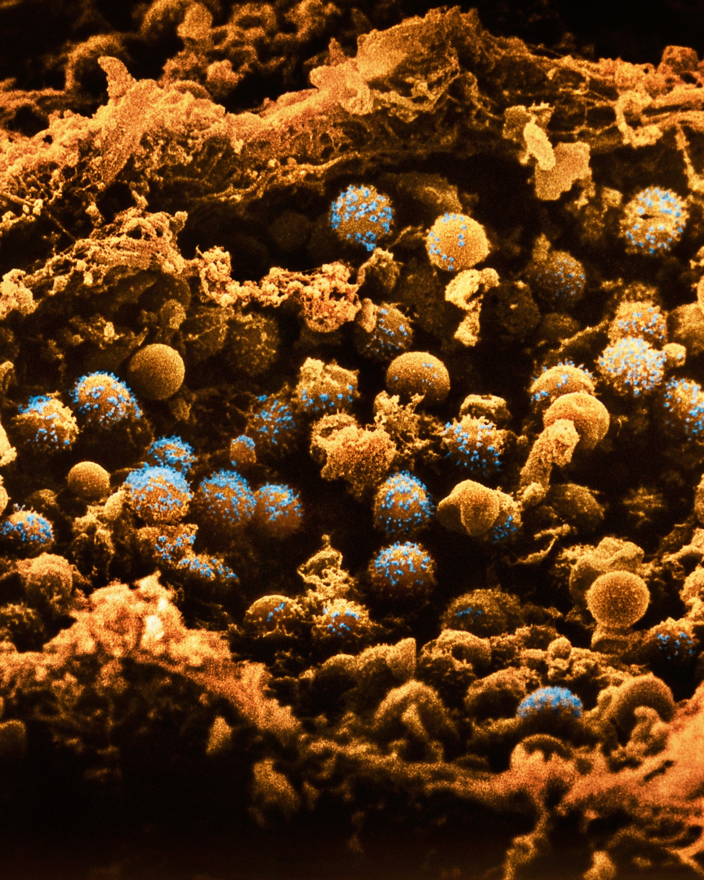 A colorized scanning micrographic view of islet cells in a pancreas, which appear as a clump of round golden cells dotted with blue secretions of the hormones insulin and glucagon.