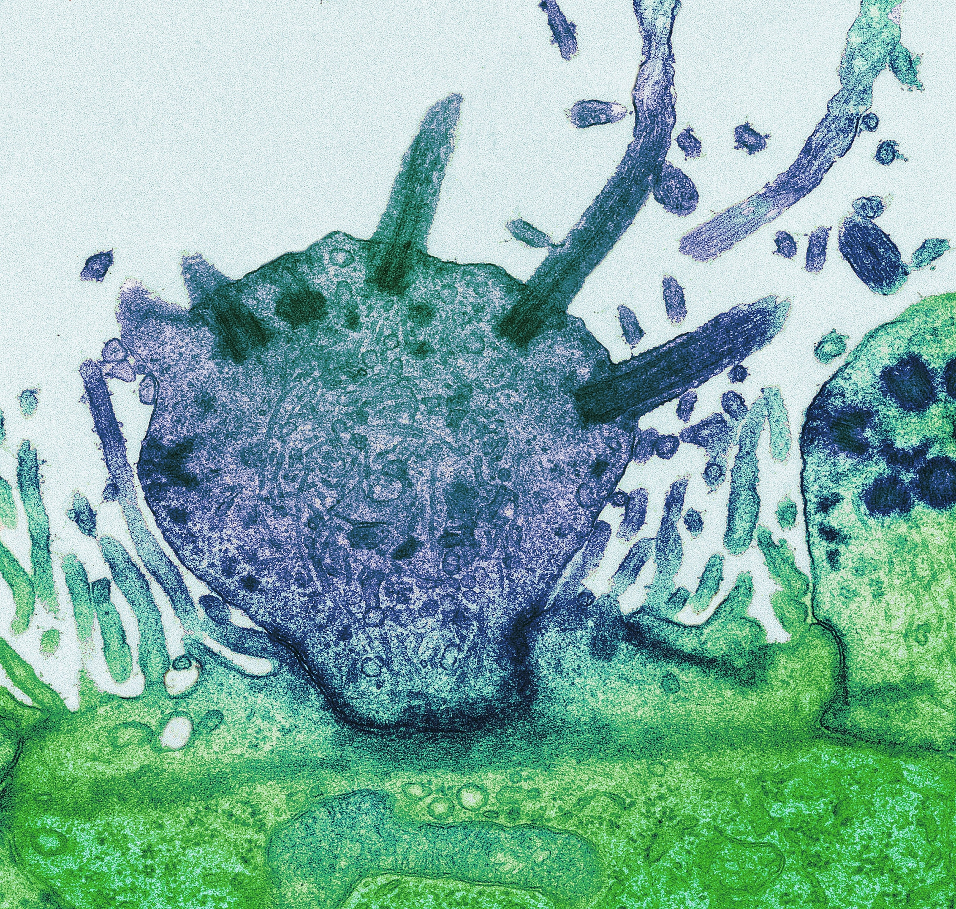 Colored transmission electron micrograph (TEM) of an olfactory neurone (blue).