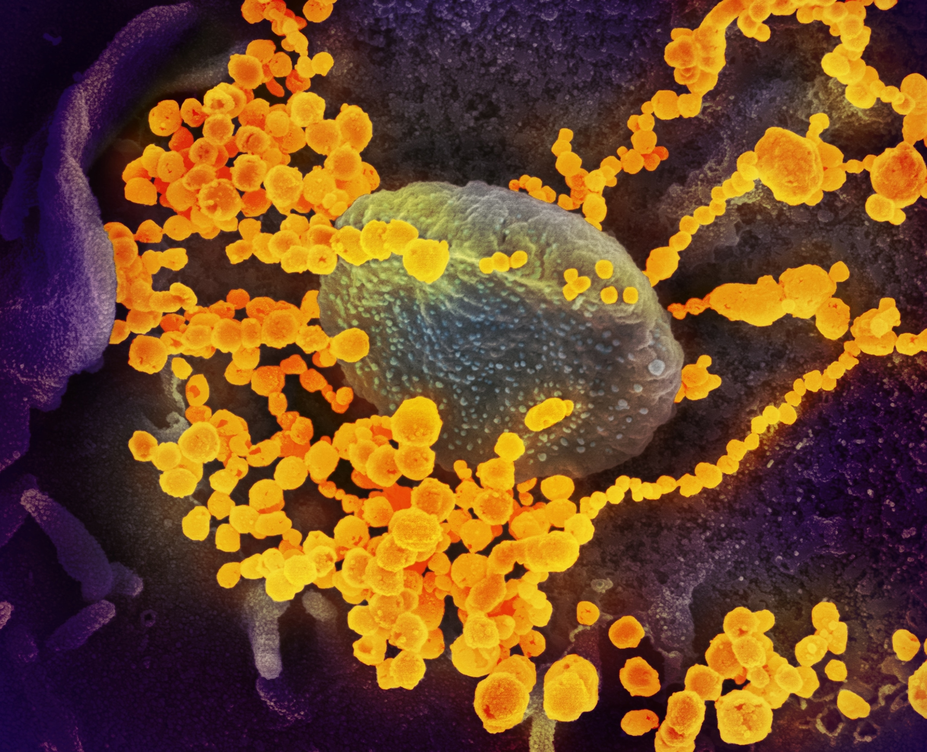 the virus that causes covid-19
