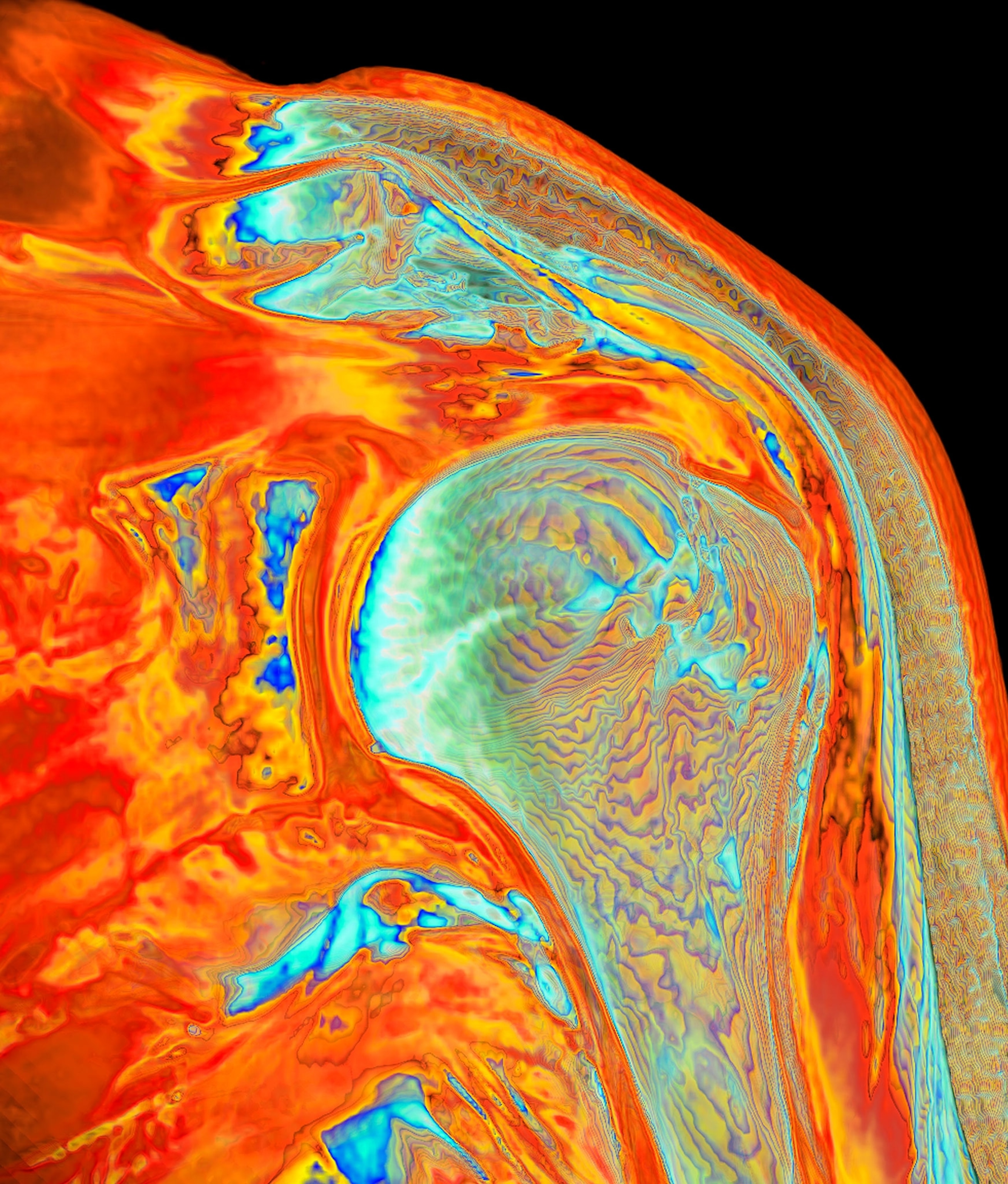 a colorful mri scan of a shoulder