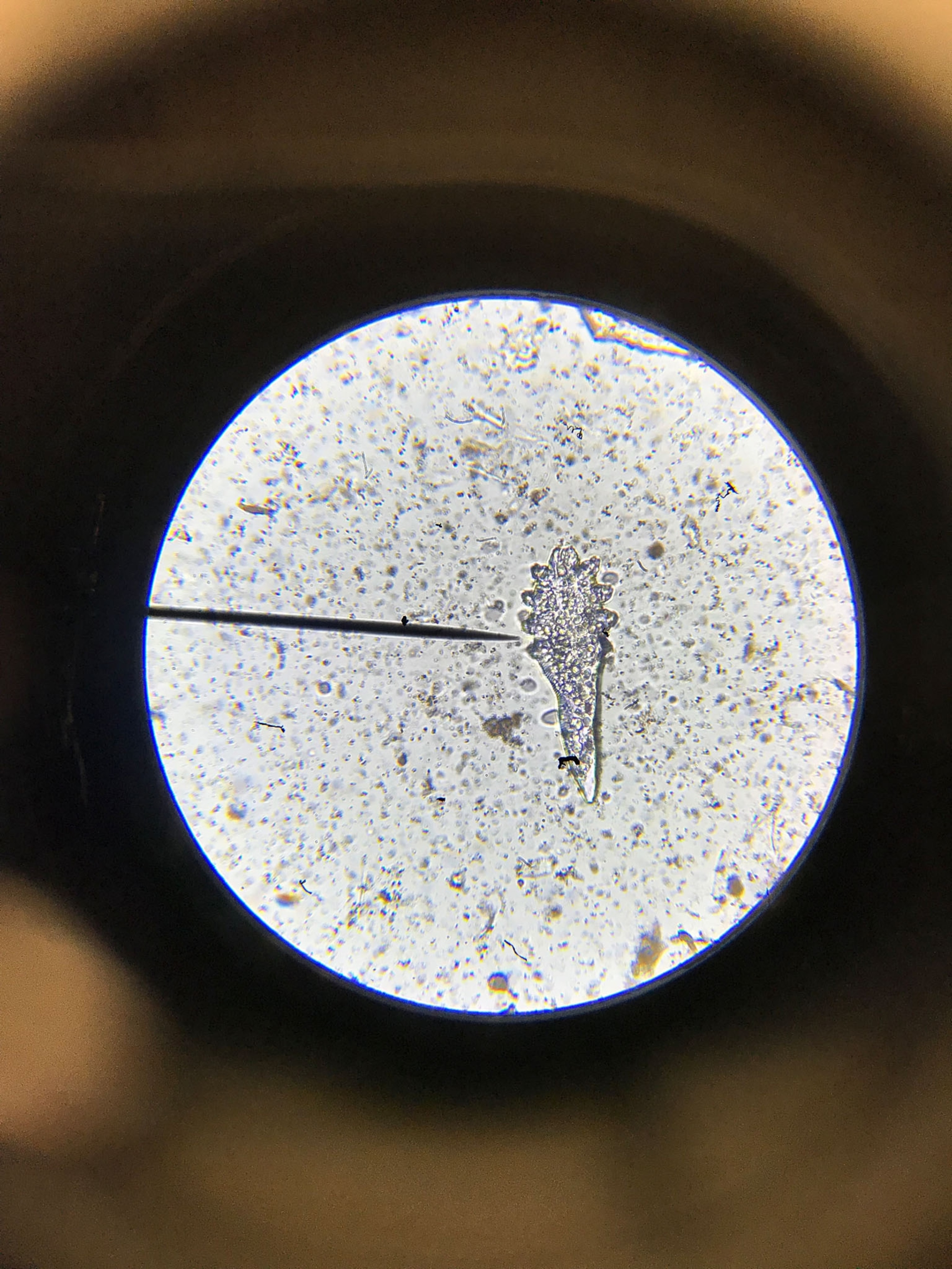 face mites under microscope.