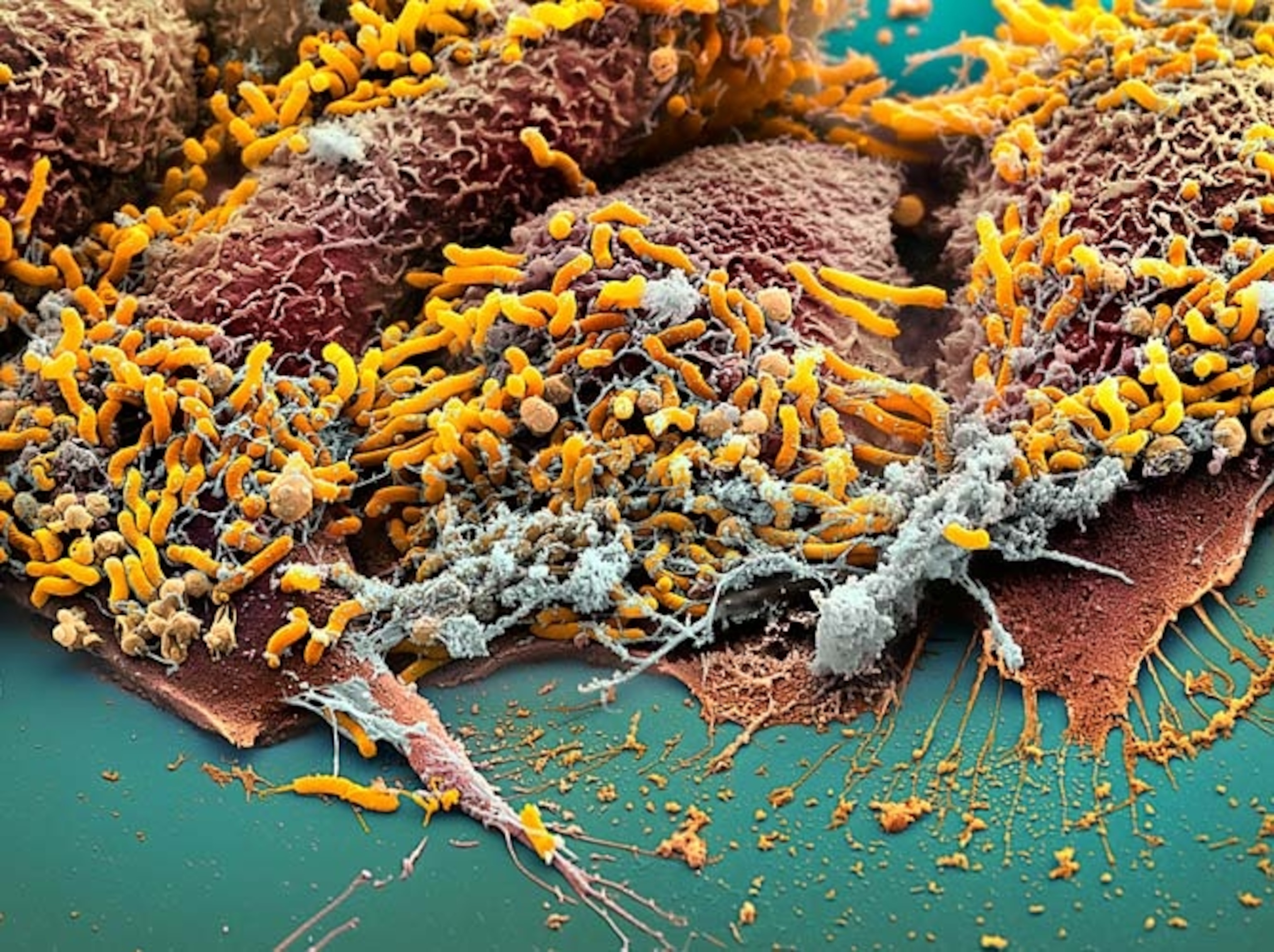 HELICOBACTER