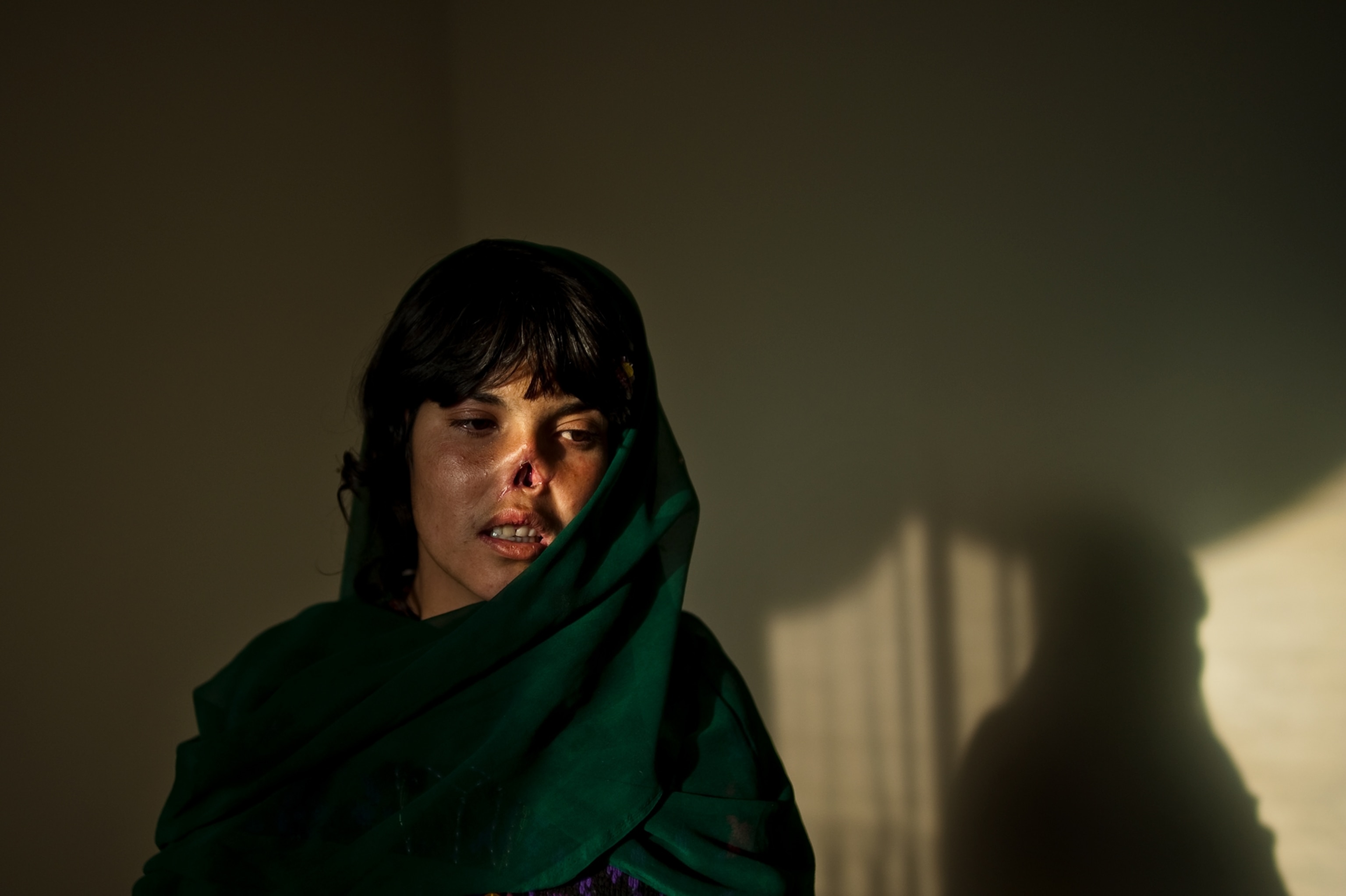 Bibi Aisha, whose husband punished her by cutting off her nose, ears and hair