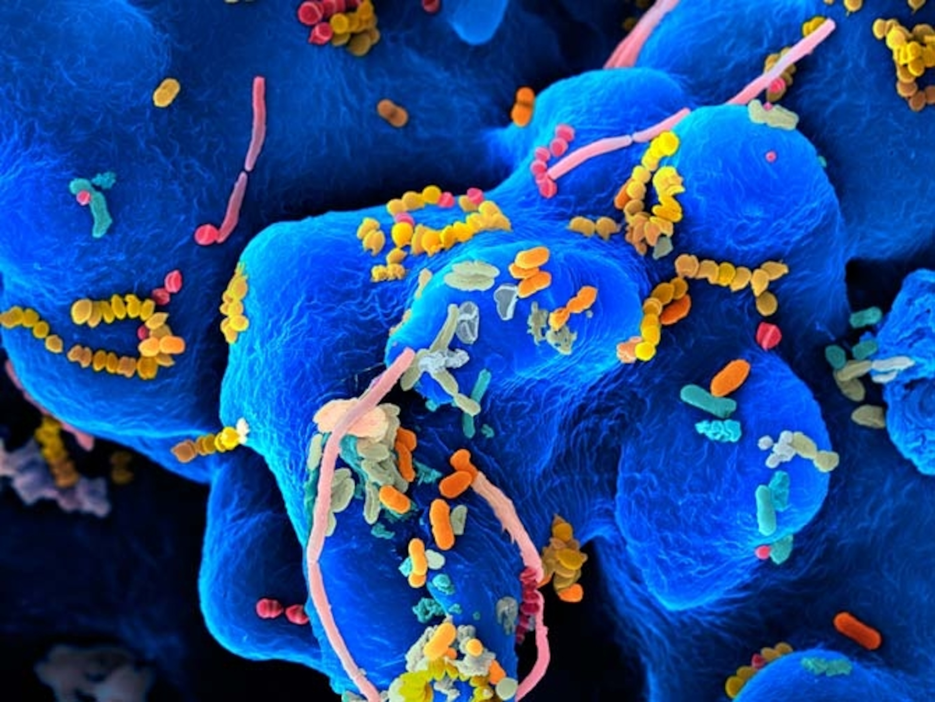 Human Mouth Microbes