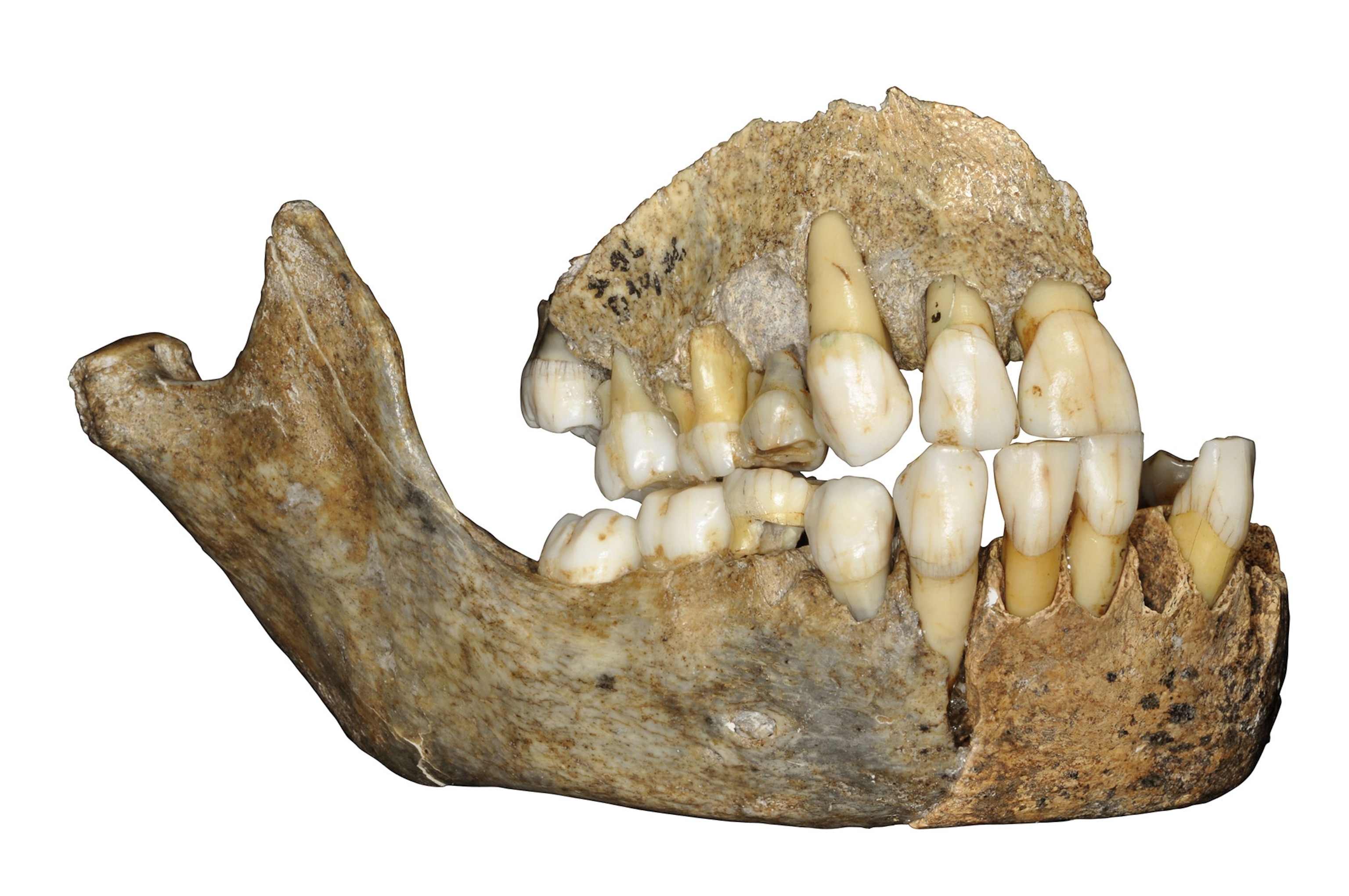 a jaw