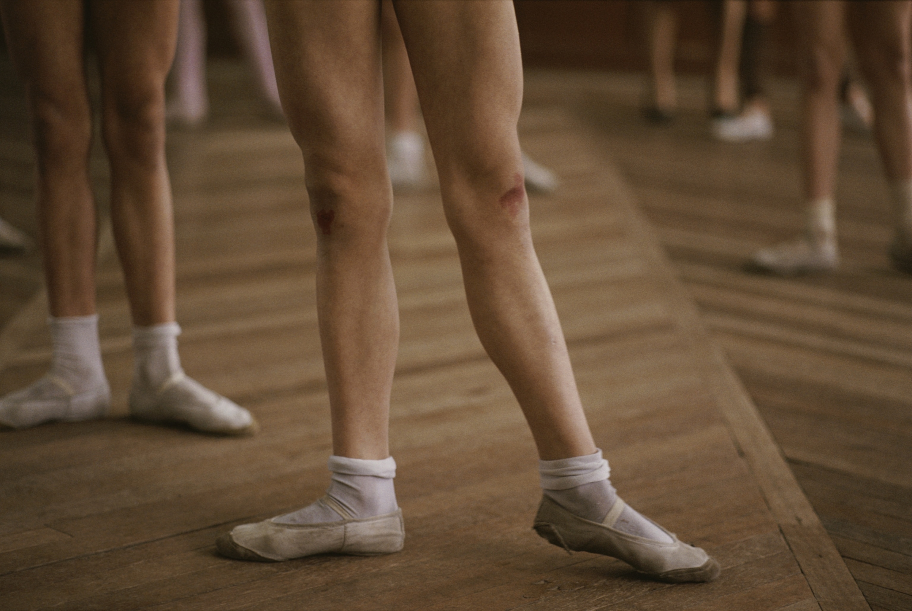 The legs of ballerina dancers during practice; one ballerina's knee is visibly scuffed.