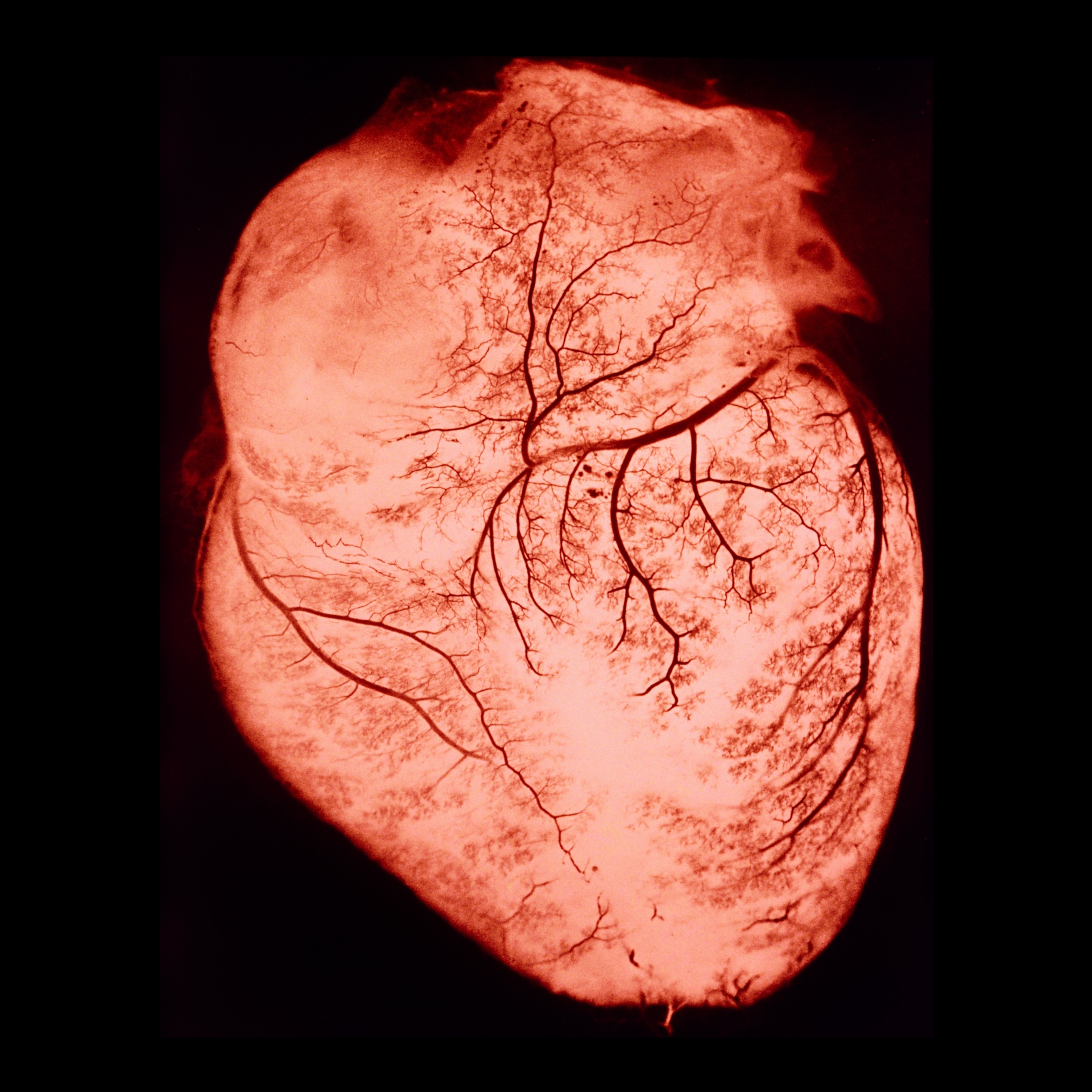 A human heart, showing the arteries and veins which supply blood to the cardiac muscles.