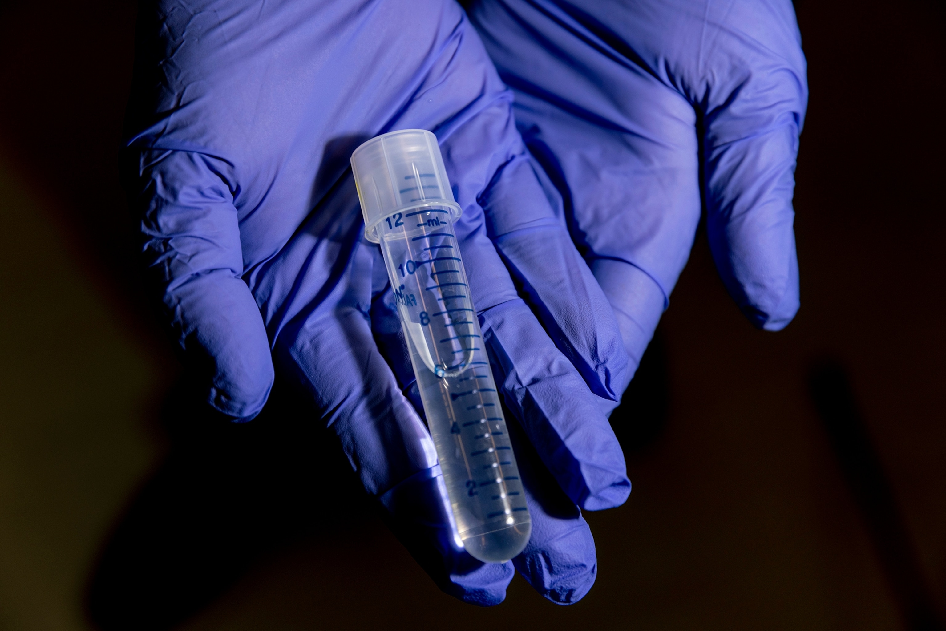 Tube with spinal fluid