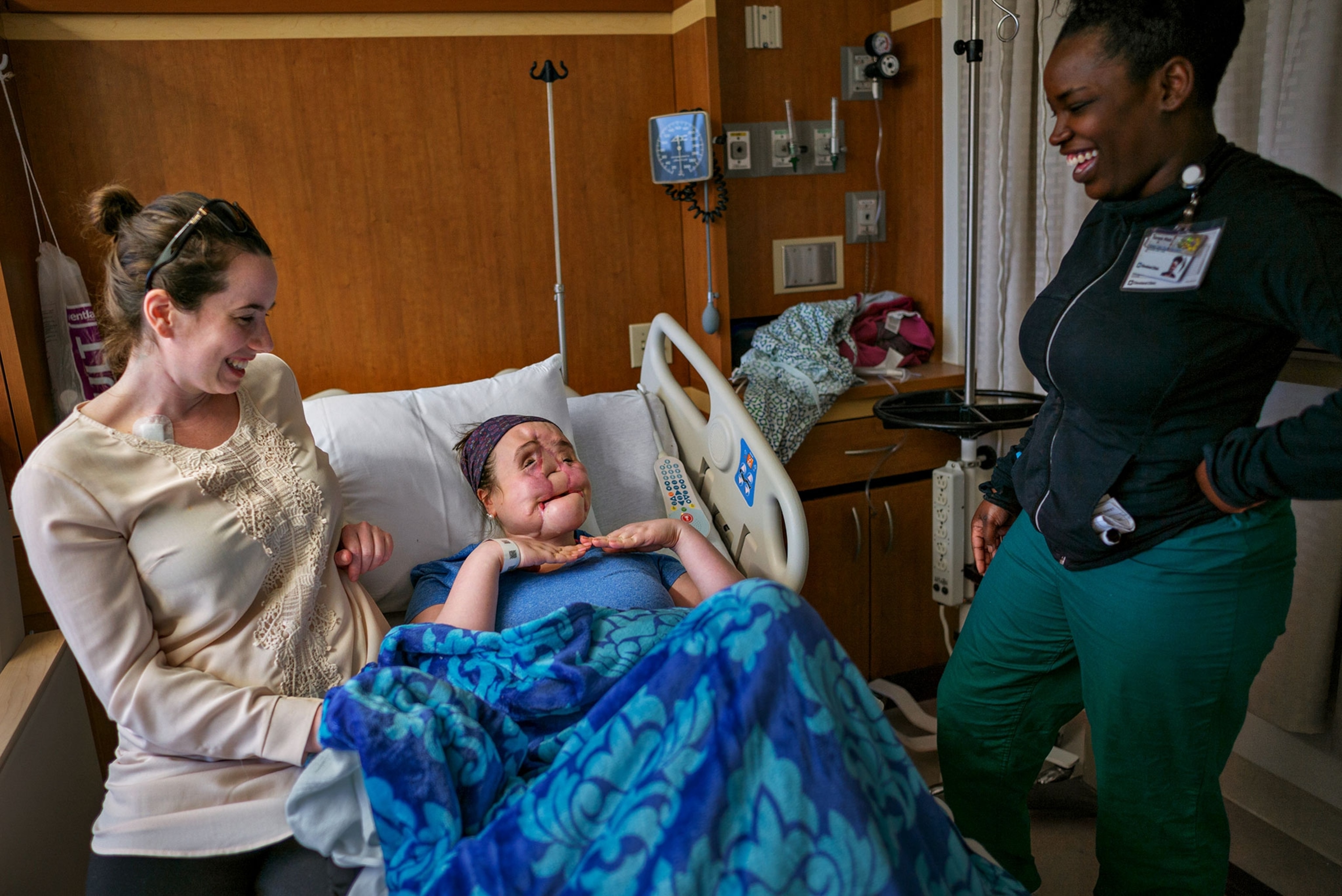 a woman before her face transplant surgery