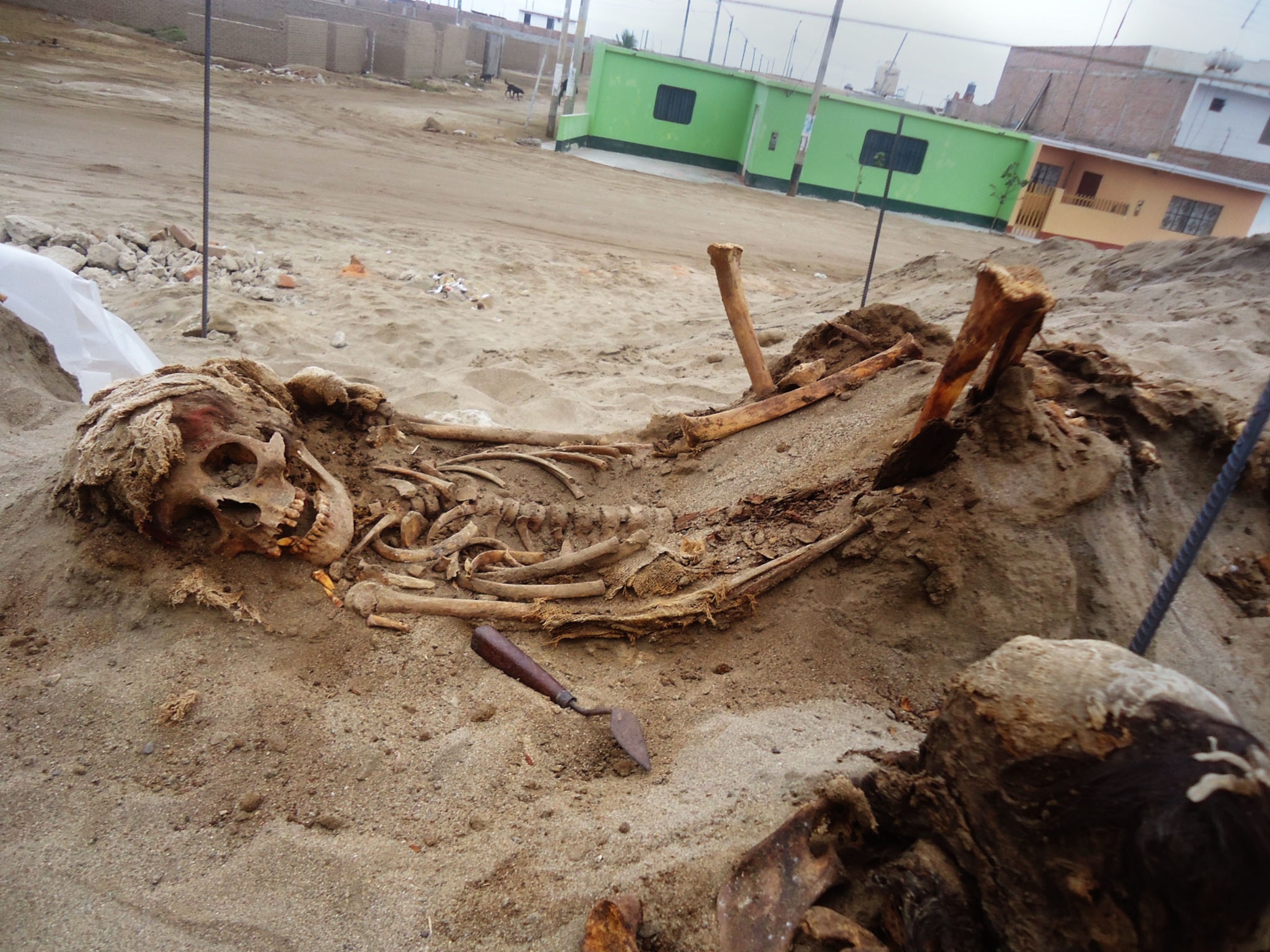 child skeleton with striking out knee.