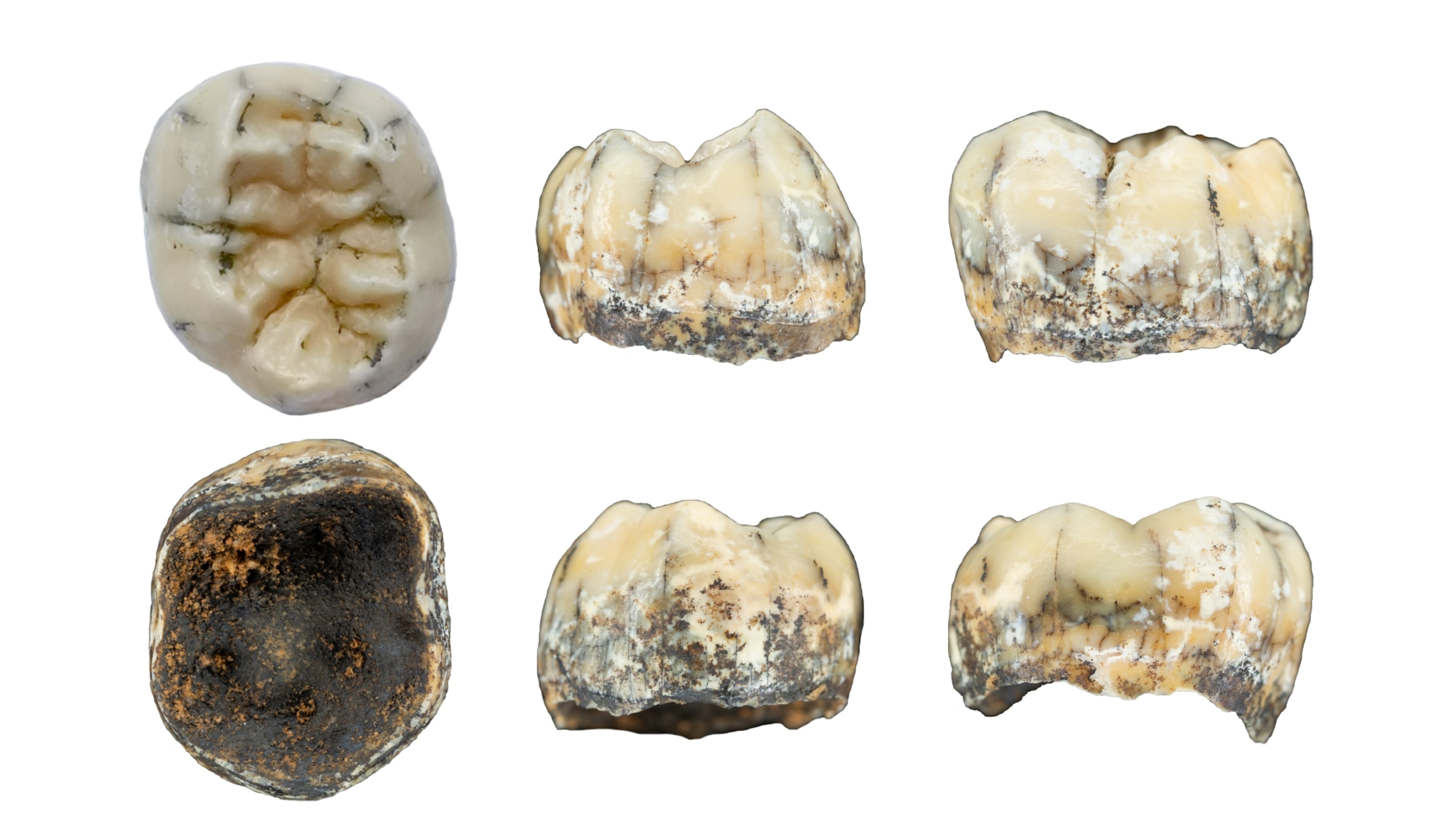 Picture of the excavated tooth as seen from various angles.