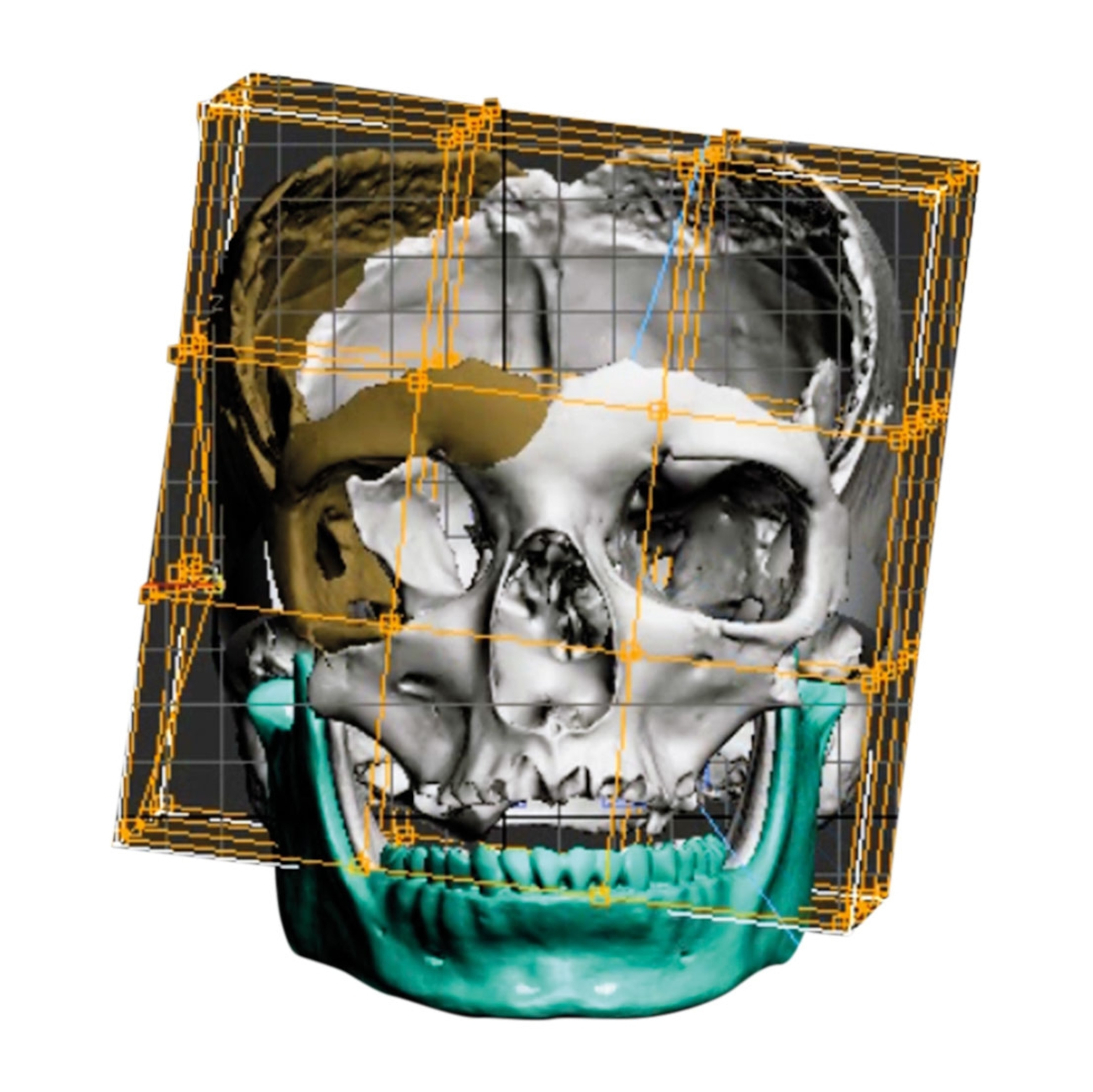 a digital rendering of the skull