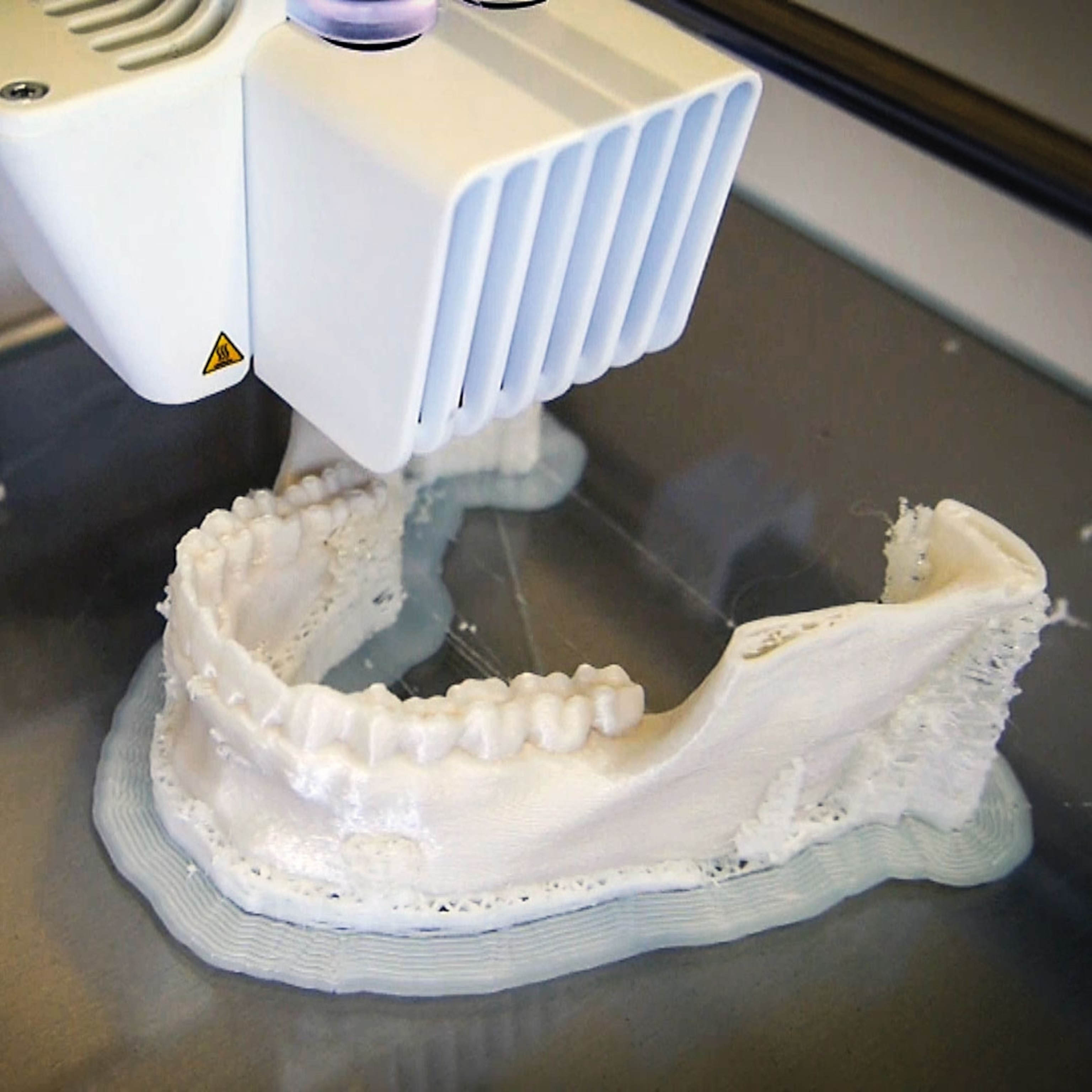 a jaw bone with teeth being printed by a 3d printer