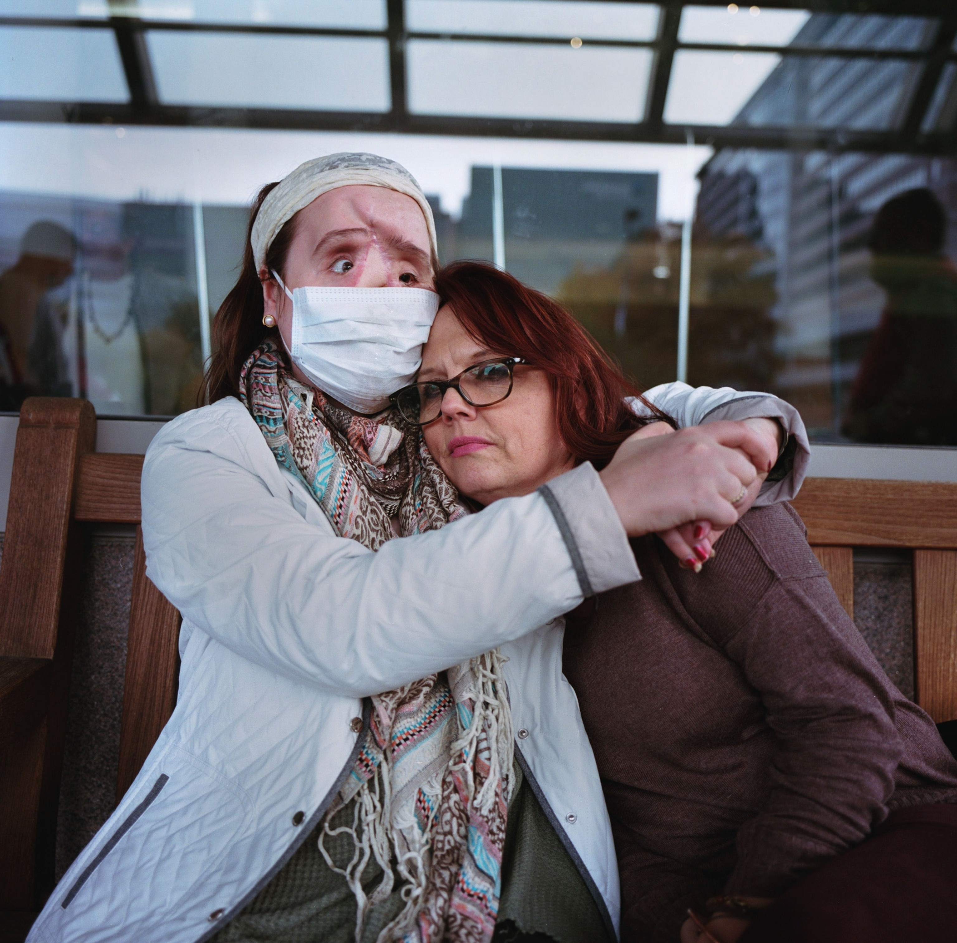 a woman awaiting a face transplant, hugging her mother
