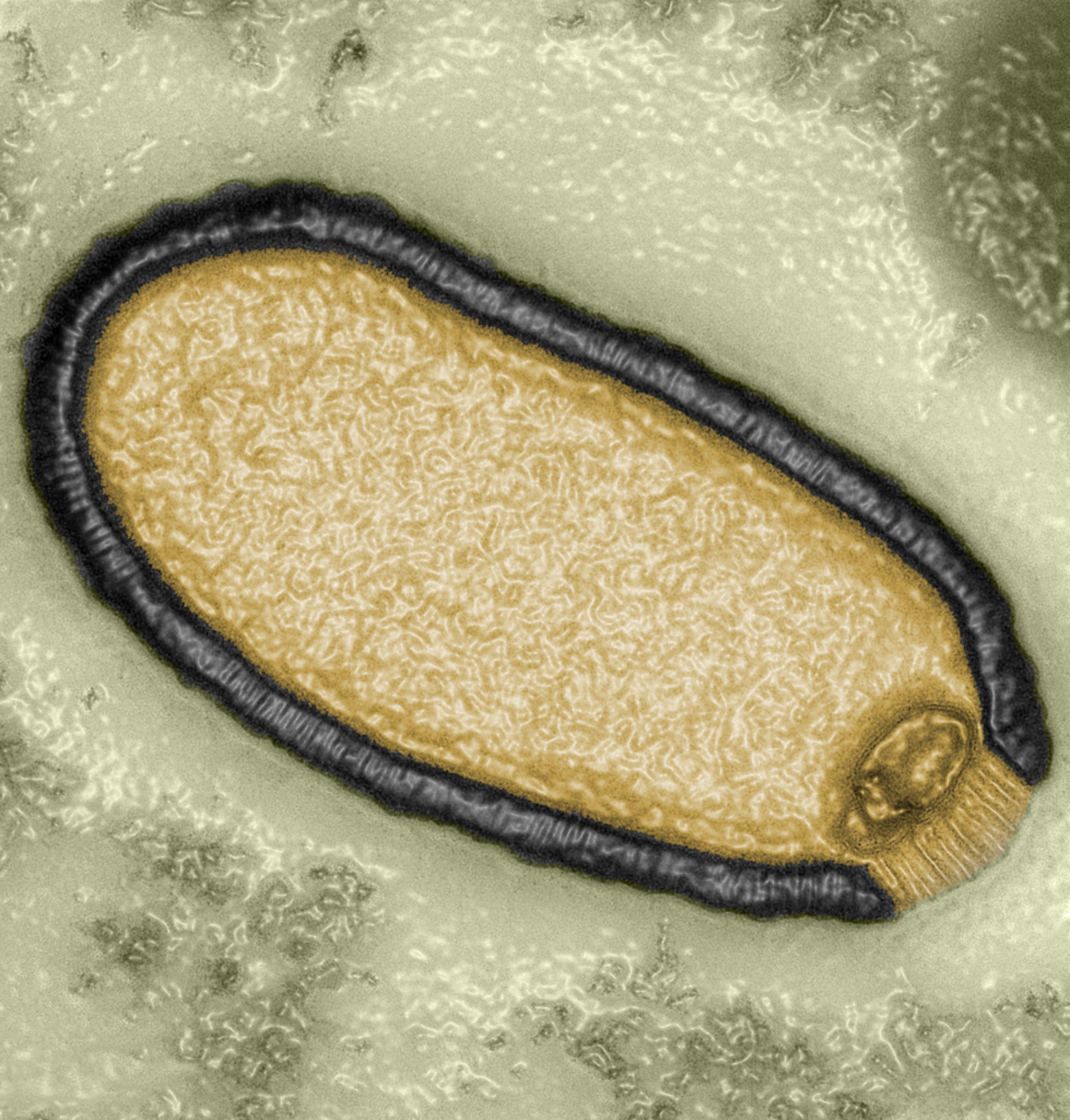 At more than 1.5 micrometers long, pithovirus is the largest virus ever discovered — larger even than some bacteria. Many of its 500 genes are unrelated to any other genes on this planet.