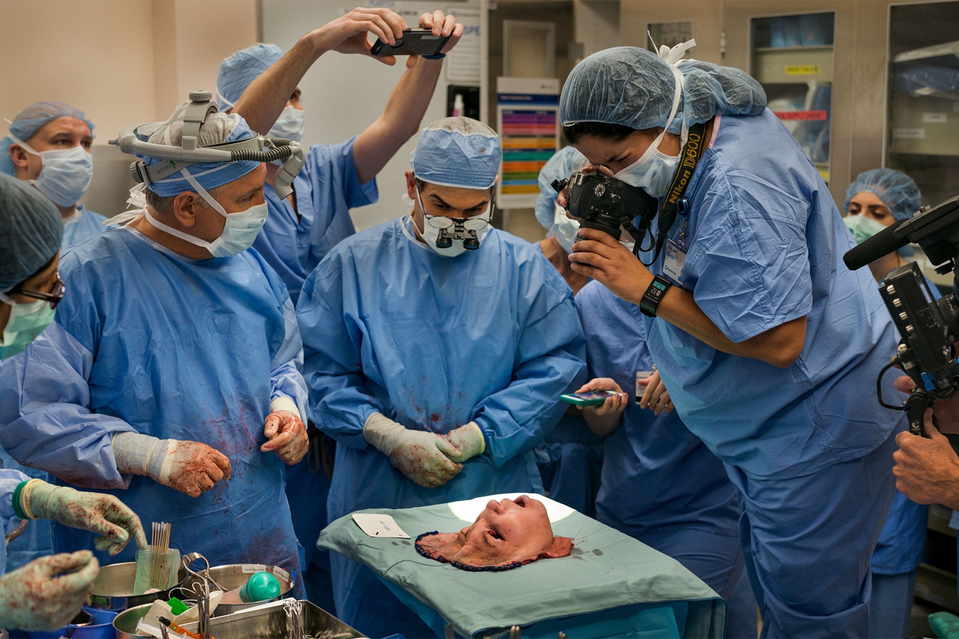 a group of surgeons examining a face for a face transplant