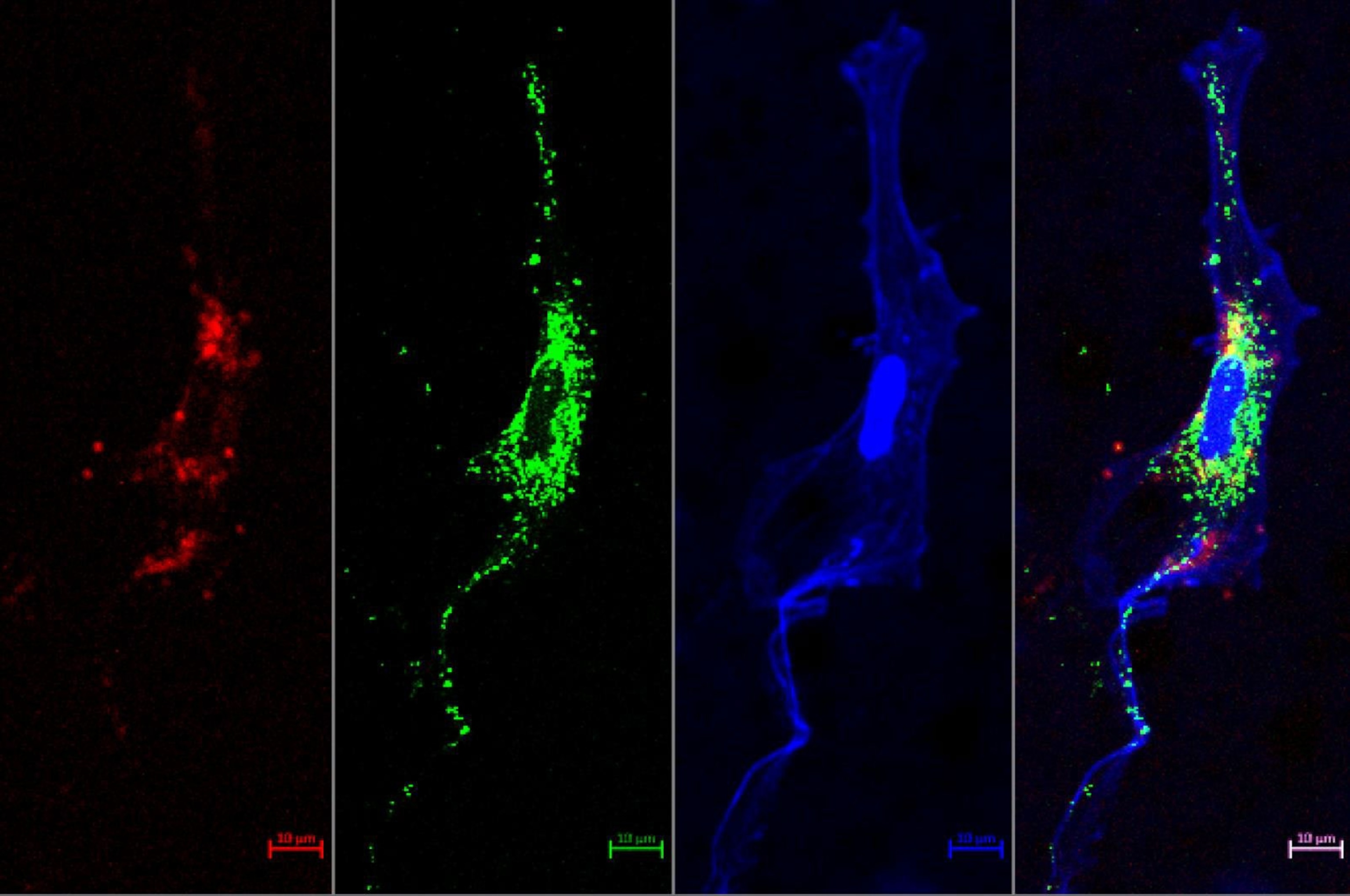 Mitochondria migration done in vitro.