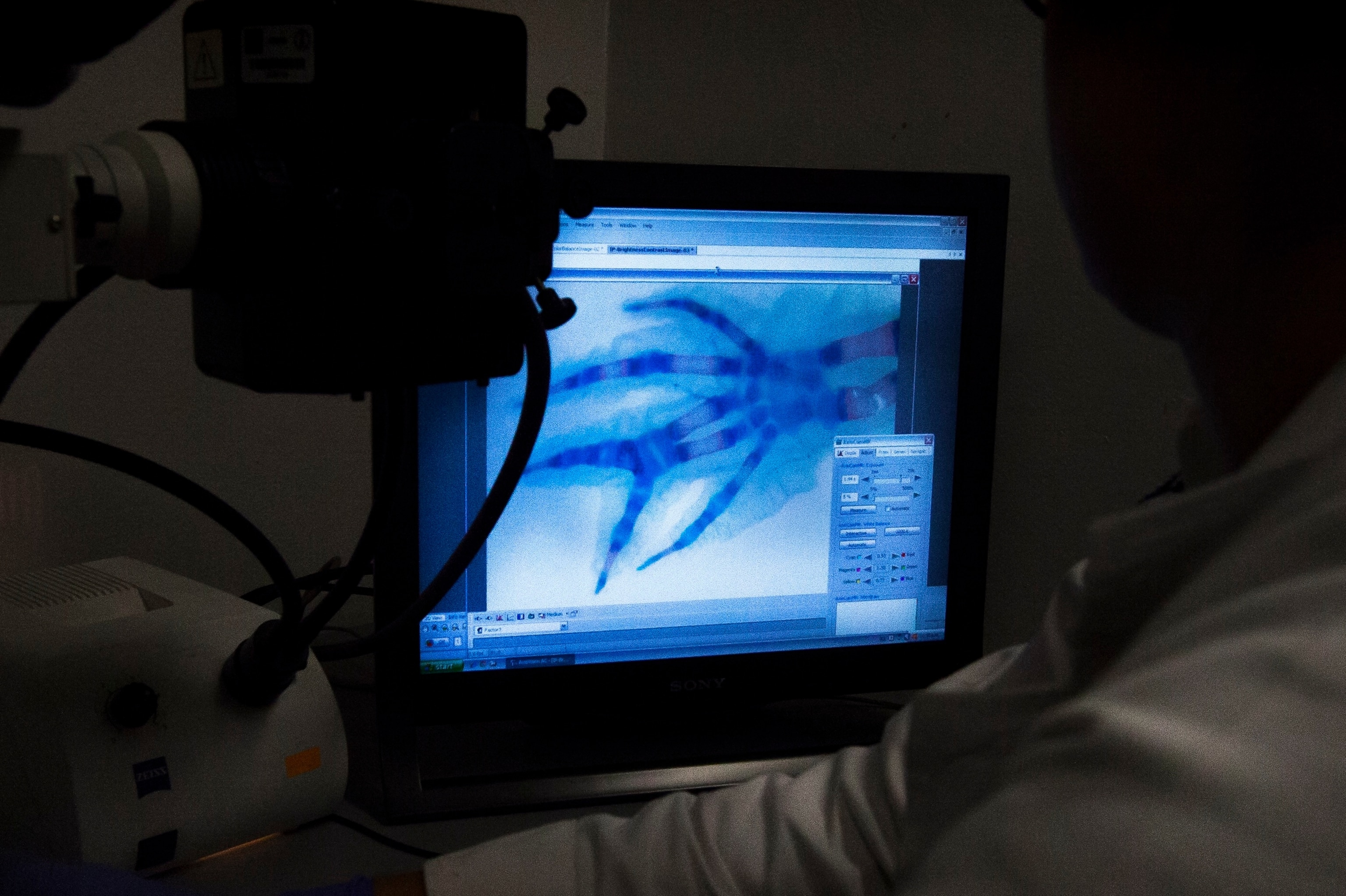 A person in a white lab coat looks at an x-ray of a salamander's foot on a monitor in the room of a research lab.