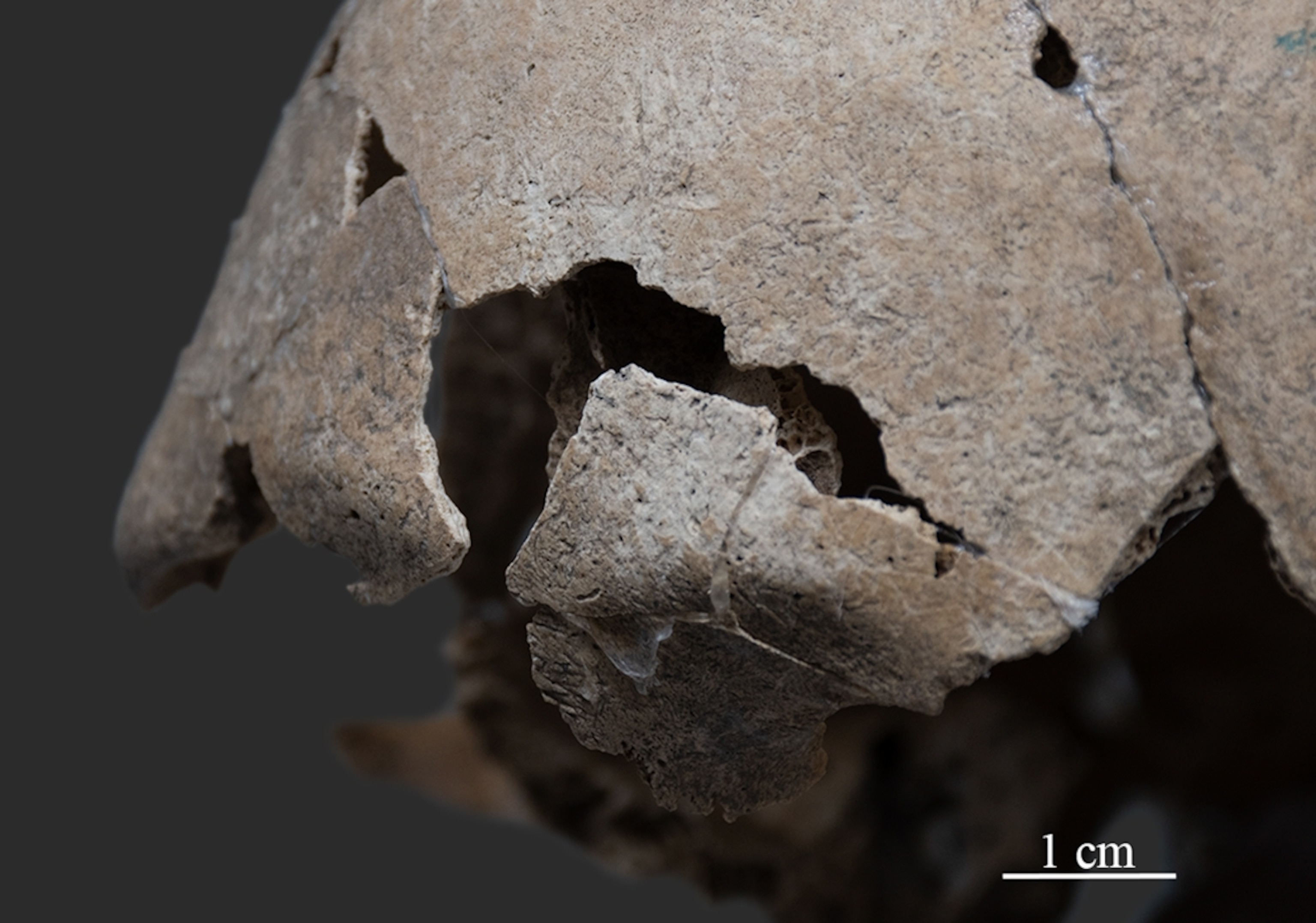 Detailed views of cranial bones that were used to determine the sex of the buried warrior.