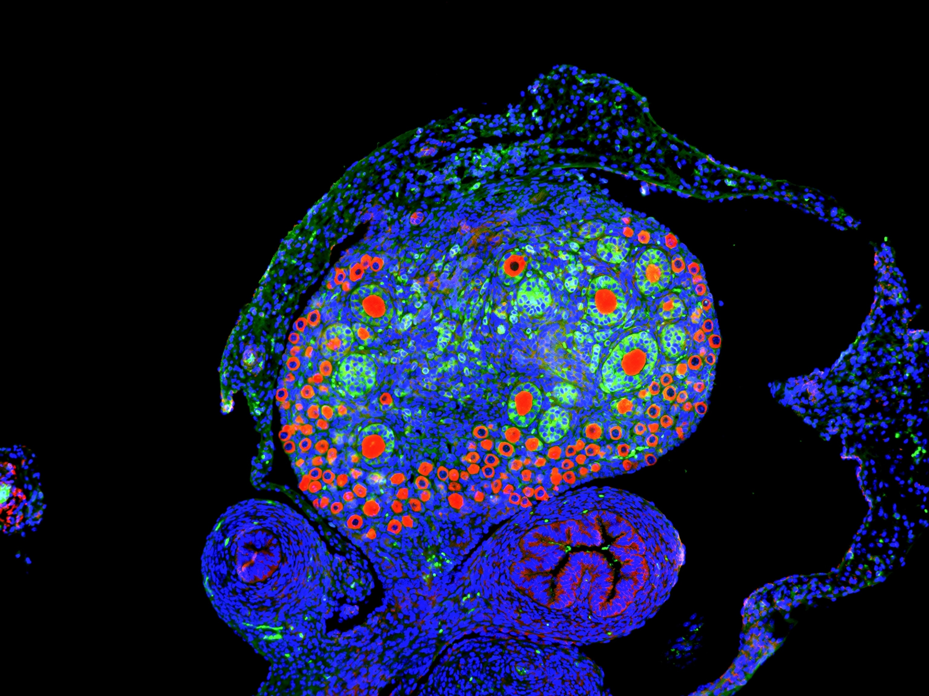 A normal, untreated mouse ovary, which shows both smaller immature oocytes and larger activated oocytes.