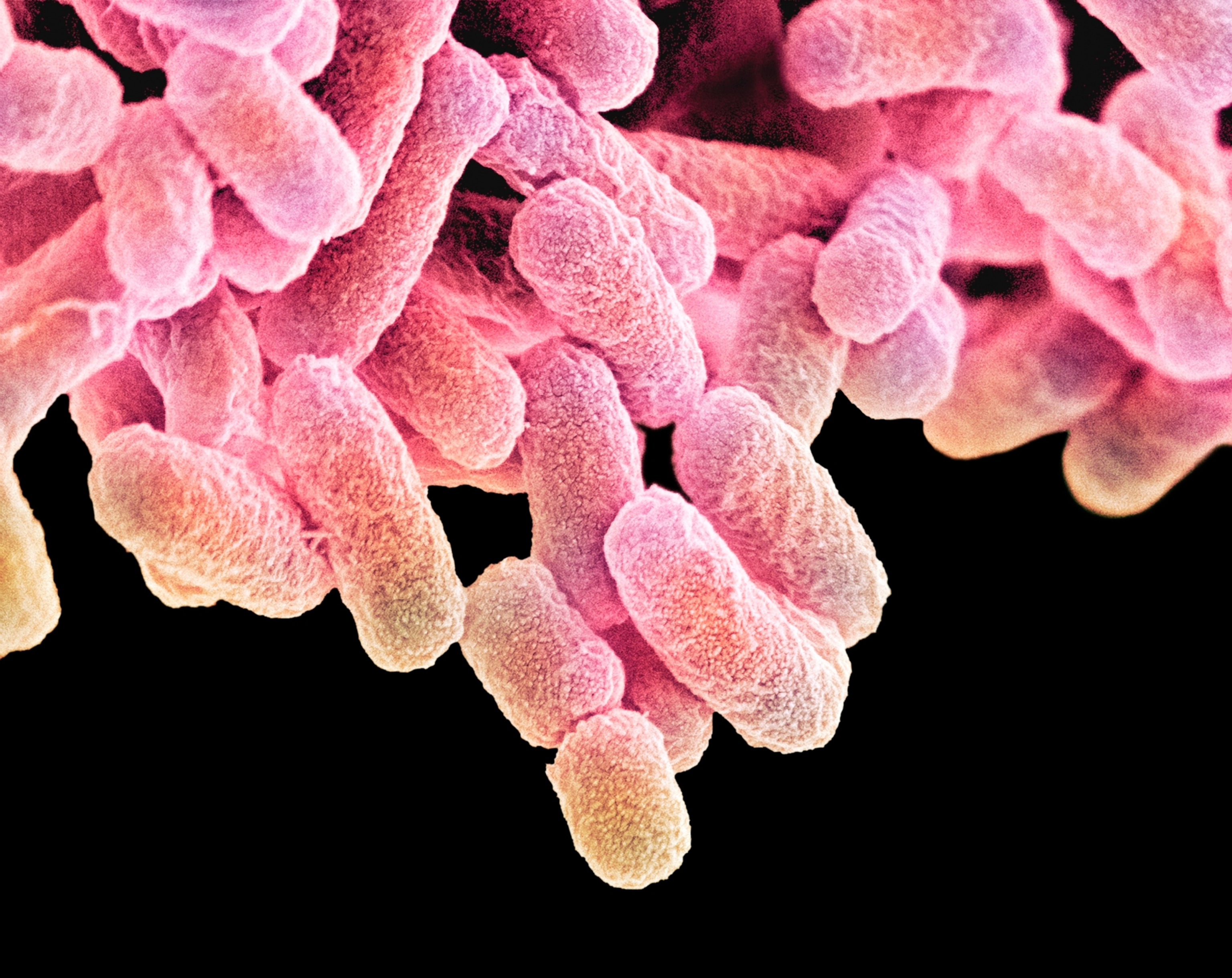 Coloured scanning electron micrograph of rod-shaped Escherichia coli bacteria.