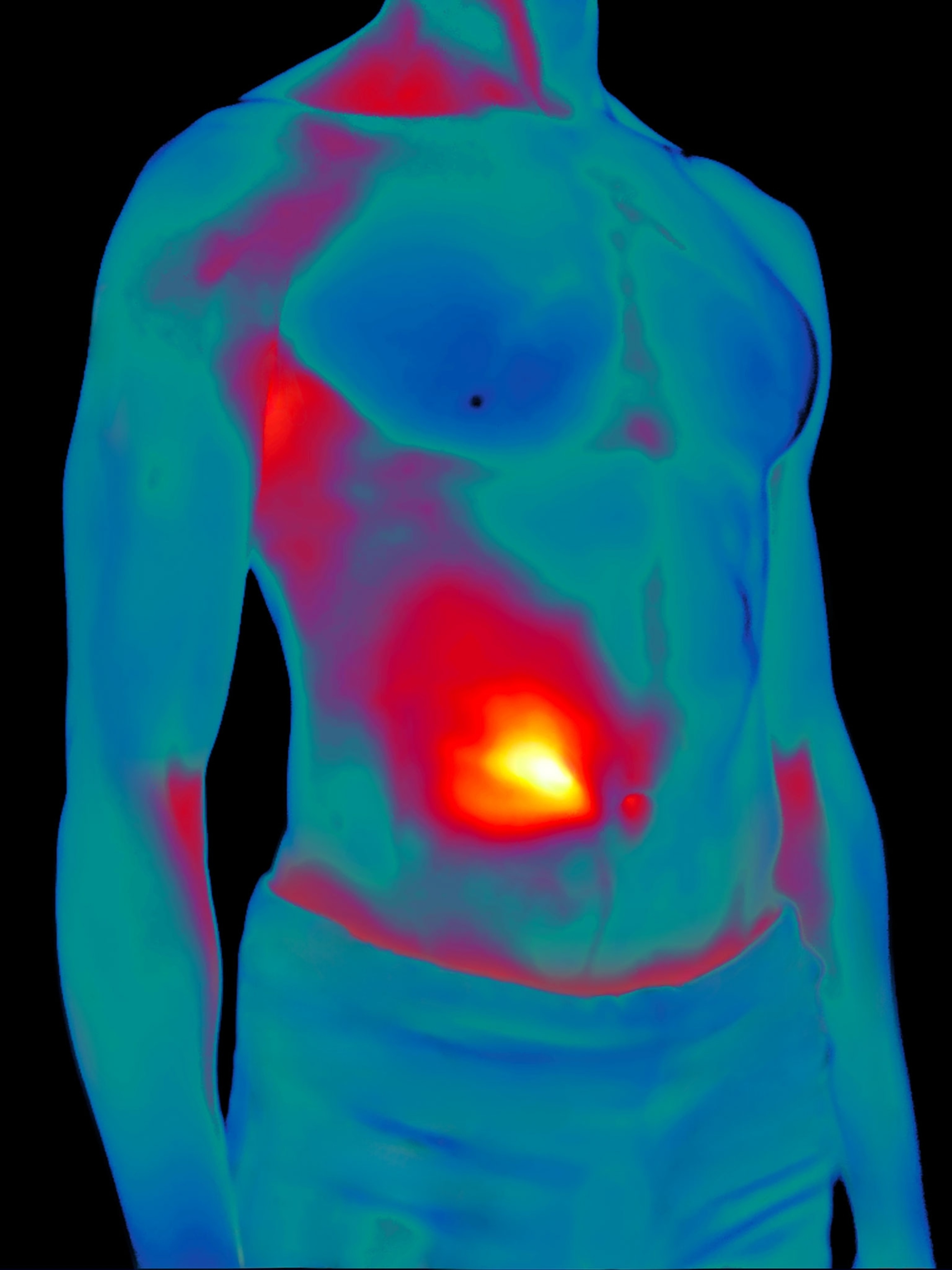 Thermal Imaging of a man's body from chin to upper thigh. A gradation of dark red to bright orange-yellow around his stomach illustrates inflammation.