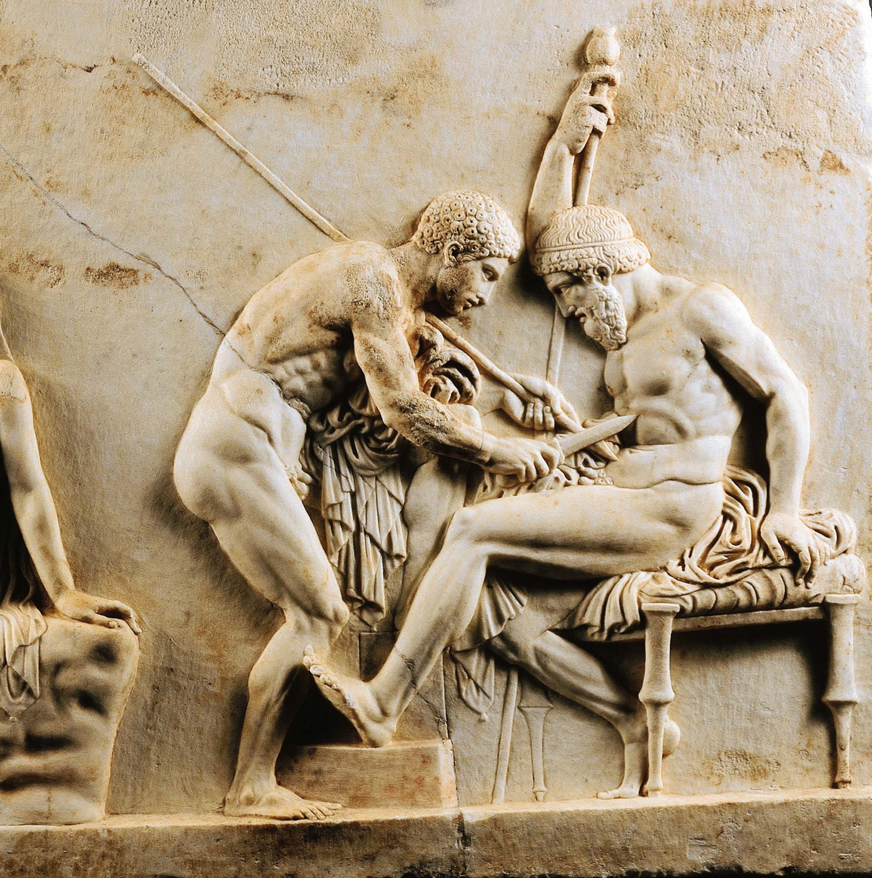 The Greek warrior Achilles treats Telephus’s poisoned wound on a first century A.D. bas-relief found in Herculaneum.