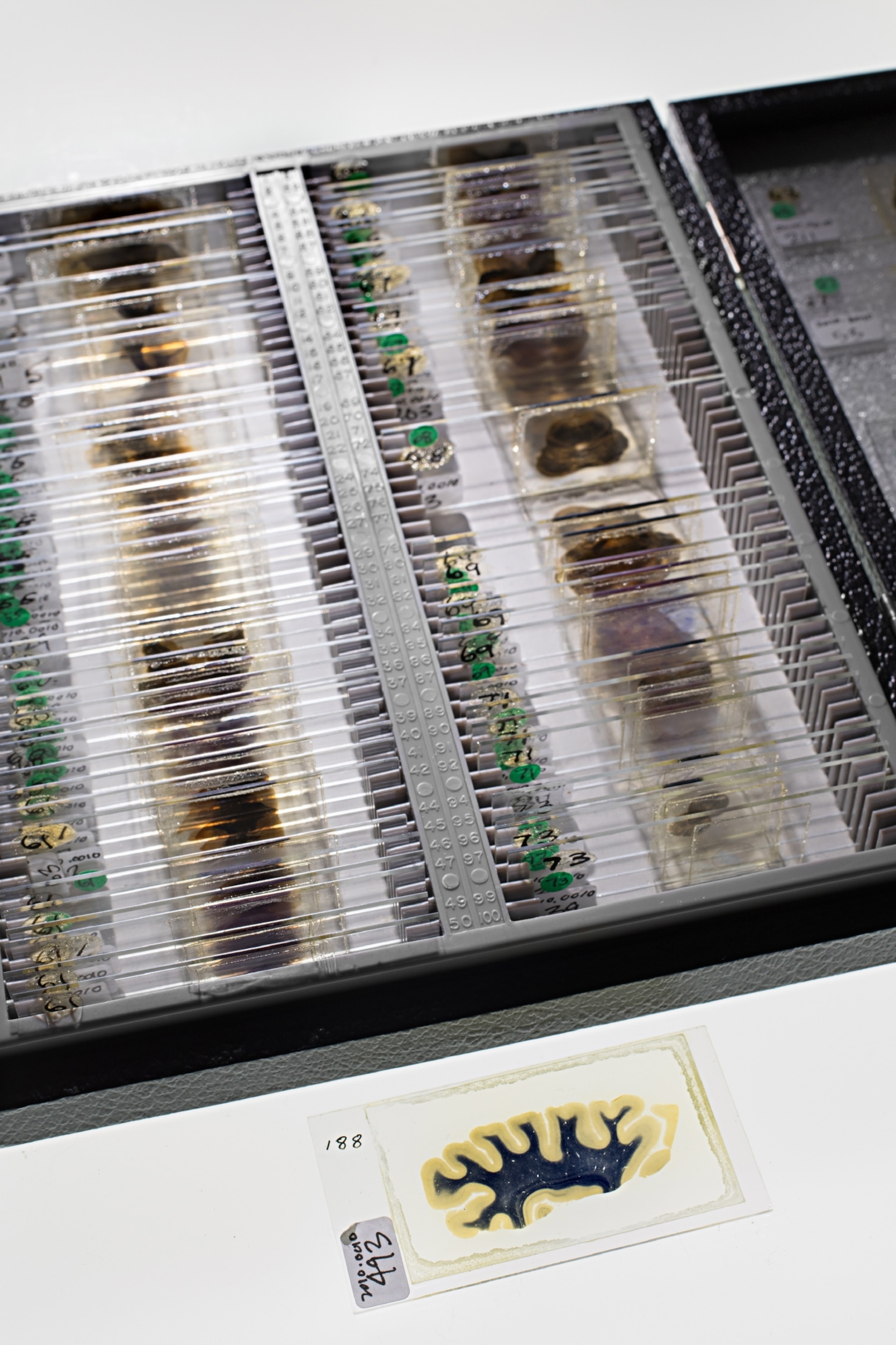 glass slides with mounted and dyed slices of Albert Einstein's brain.