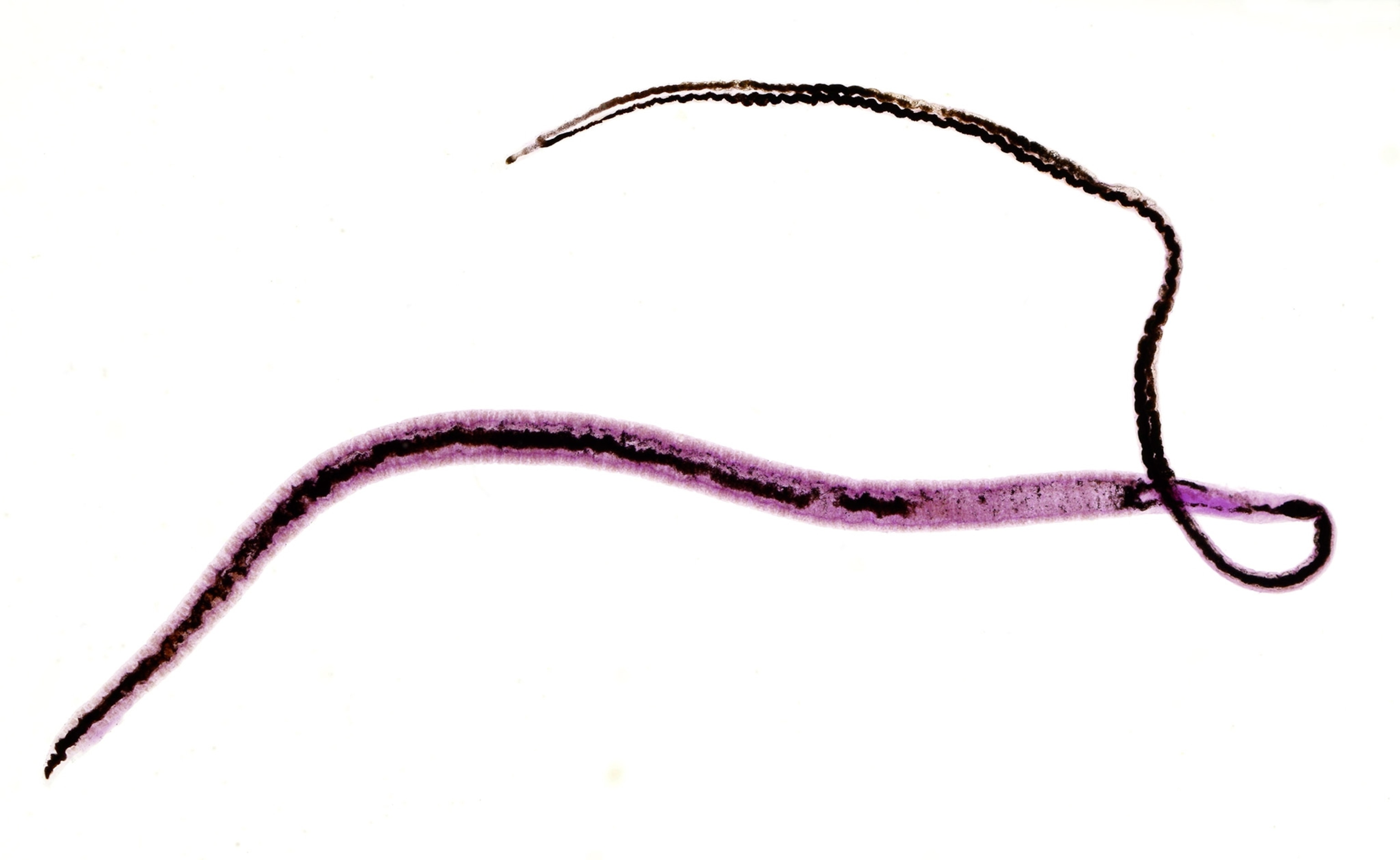 A thin long purple parasite on a white backround.
