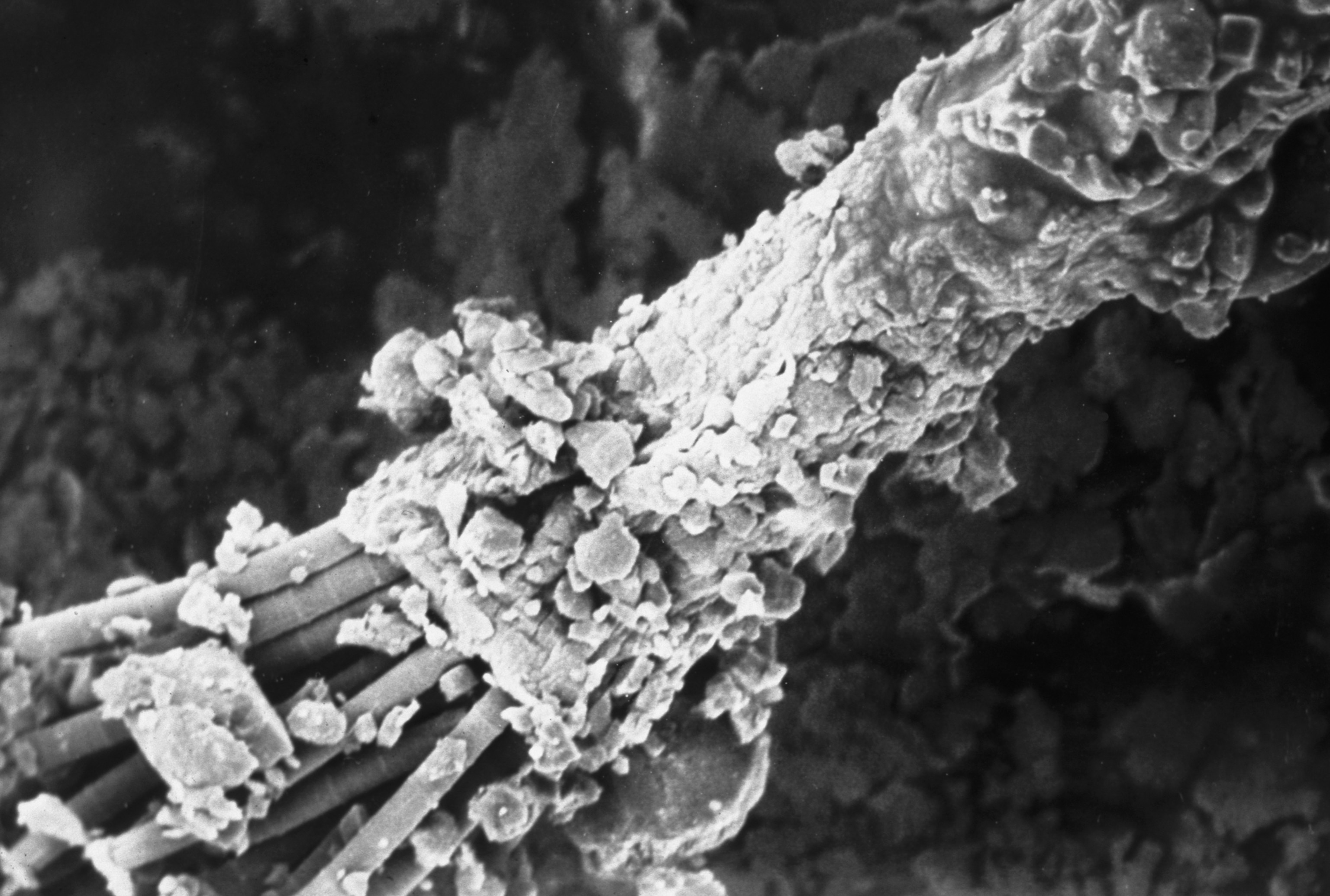 magnified sheaths of cyanobacteria