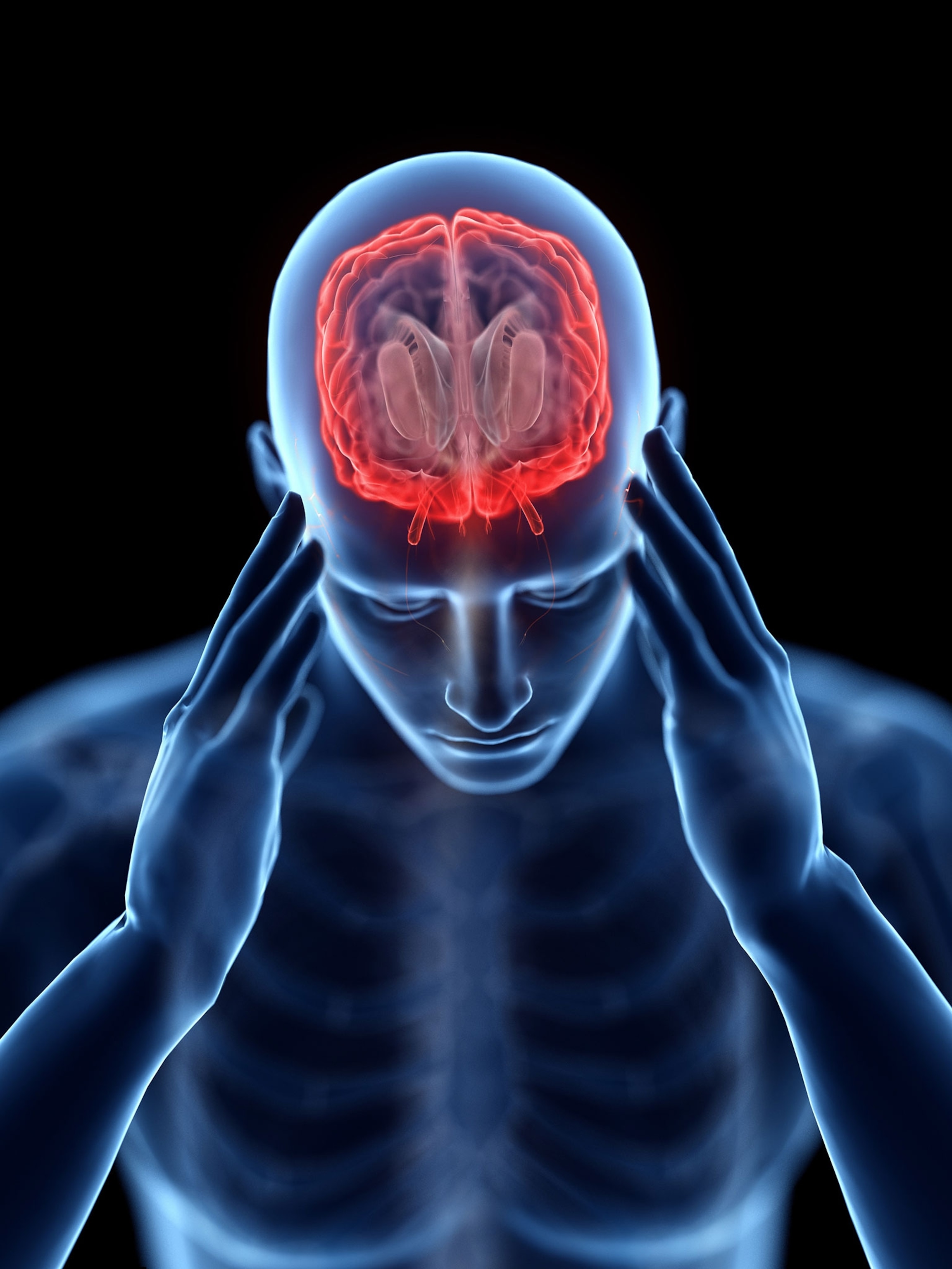 A 3D rendered illustration of a man with a headache made to look like an x-ray with a blue body and red brain.