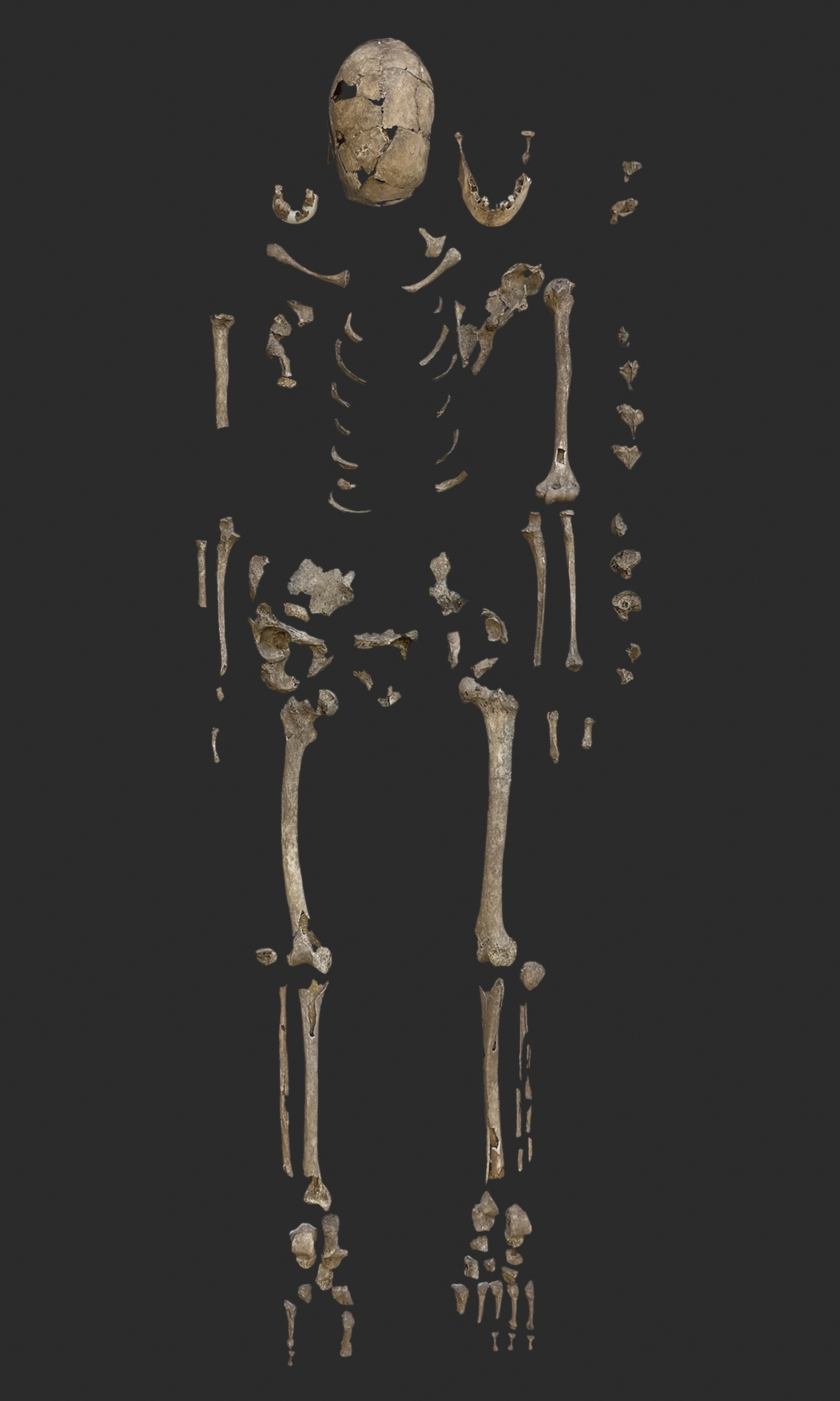 Various human bone fragments laid out in the form of an incomplete skeletal system